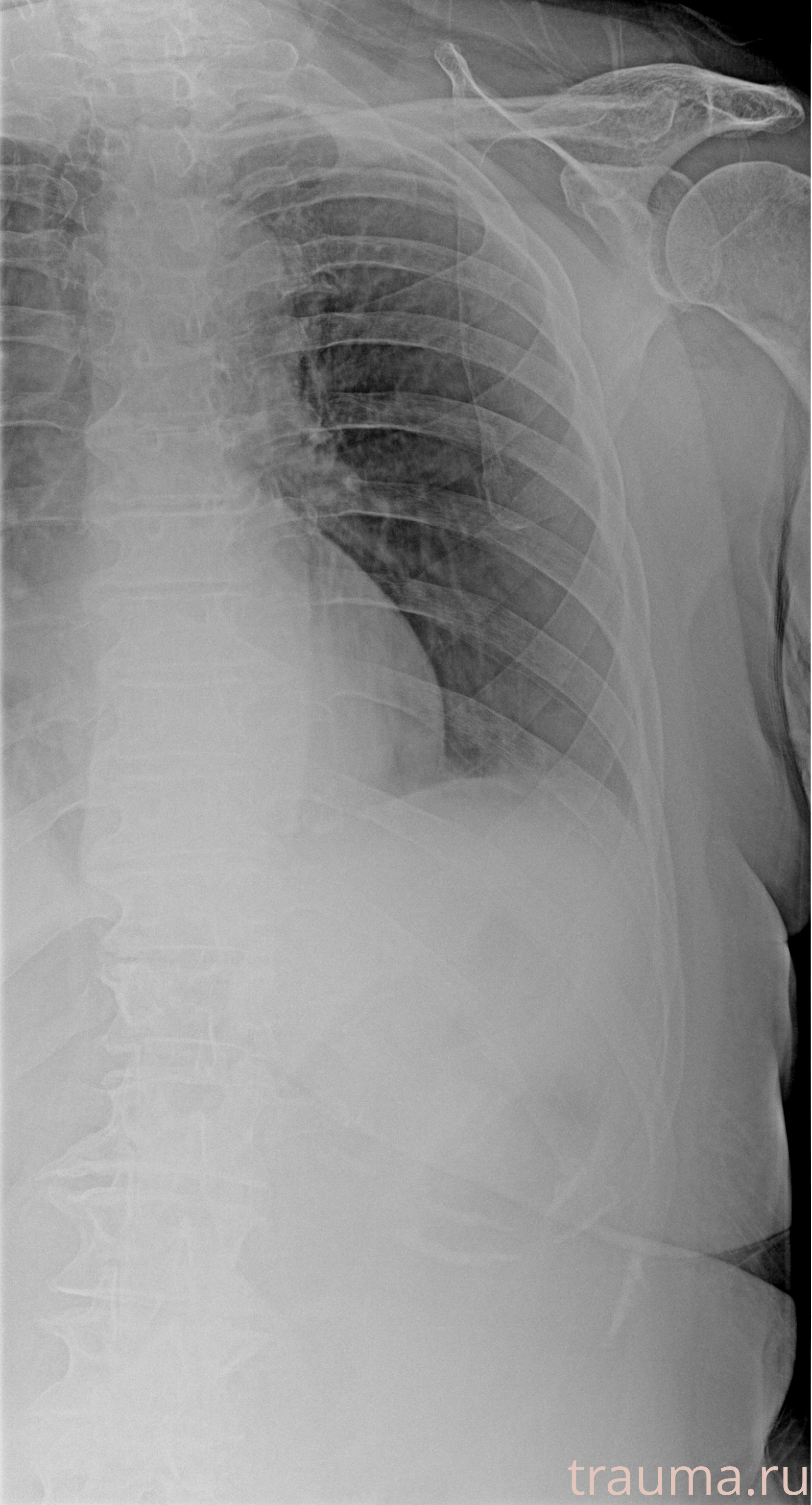 Рентген на дому: по вашему адресу приезжает врач-рентгенолог, травматолог-ортопед с мобильным рентгеновским аппаратом, проводит диагностику травмы или заболевания, делает необходимые рентгенограммы, дает рекомендации по дальнейшему лечению. Получить качественные снимки в домашних условиях возможно благодаря уникальной методике, разработанной МосРентген Центром для института  Склифосовского