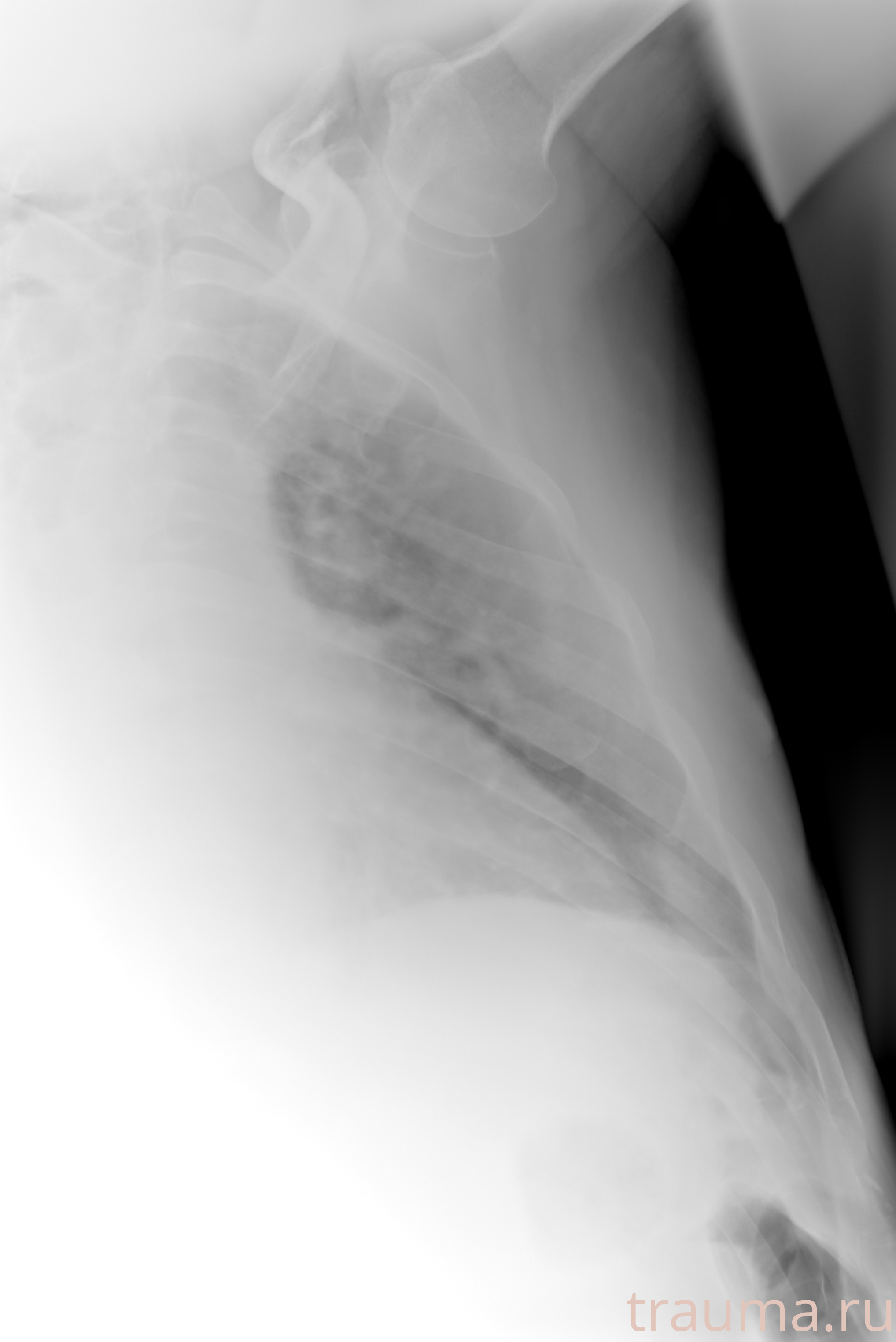 Рентген на дому: по вашему адресу приезжает врач-рентгенолог, травматолог-ортопед с мобильным рентгеновским аппаратом, проводит диагностику травмы или заболевания, делает необходимые рентгенограммы, дает рекомендации по дальнейшему лечению. Получить качественные снимки в домашних условиях возможно благодаря уникальной методике, разработанной МосРентген Центром для института  Склифосовского