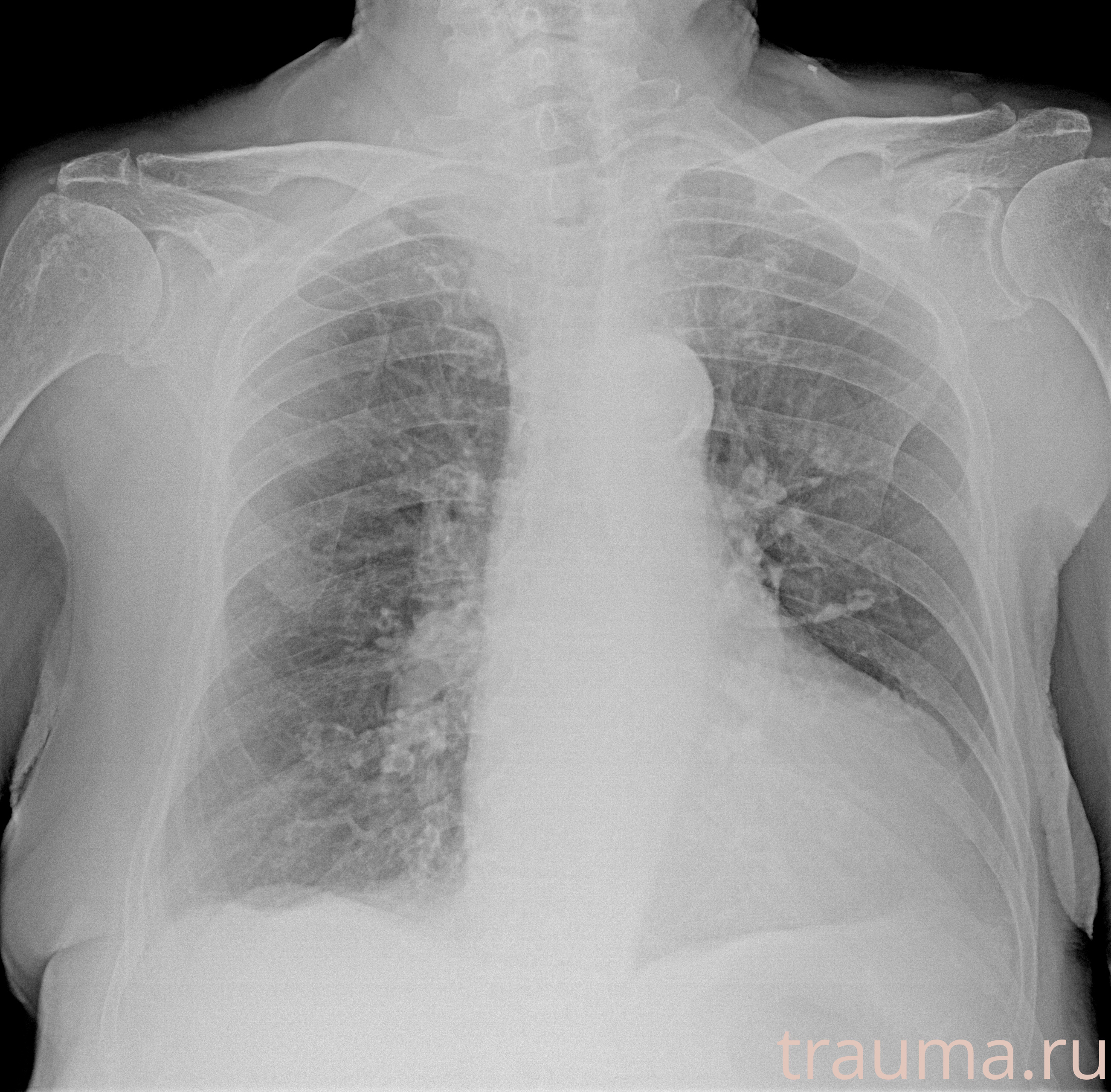 Рентген на дому: по вашему адресу приезжает врач-рентгенолог, травматолог-ортопед с мобильным рентгеновским аппаратом, проводит диагностику травмы или заболевания, делает необходимые рентгенограммы, дает рекомендации по дальнейшему лечению. Получить качественные снимки в домашних условиях возможно благодаря уникальной методике, разработанной МосРентген Центром для института  Склифосовского