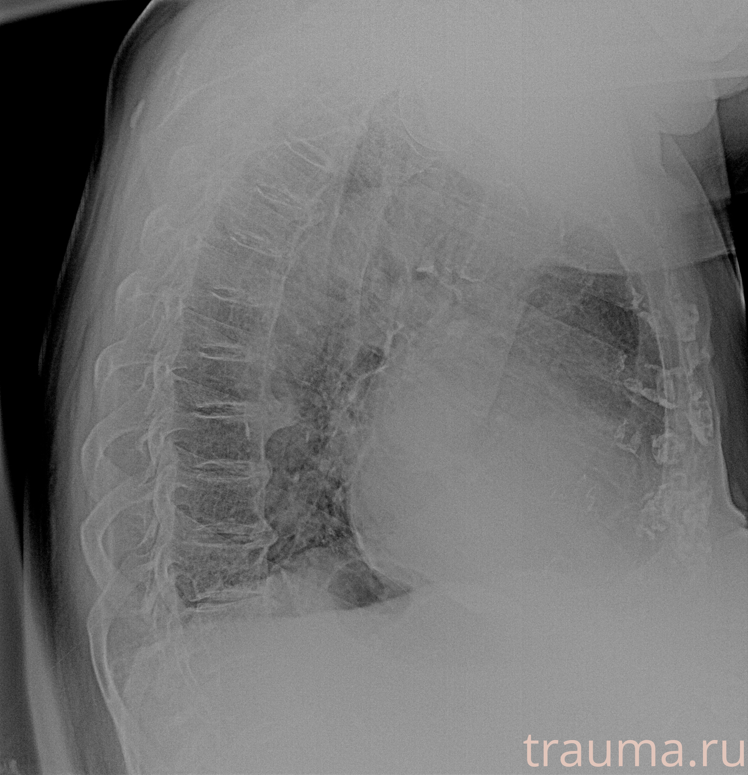 Рентген на дому: по вашему адресу приезжает врач-рентгенолог, травматолог-ортопед с мобильным рентгеновским аппаратом, проводит диагностику травмы или заболевания, делает необходимые рентгенограммы, дает рекомендации по дальнейшему лечению. Получить качественные снимки в домашних условиях возможно благодаря уникальной методике, разработанной МосРентген Центром для института  Склифосовского
