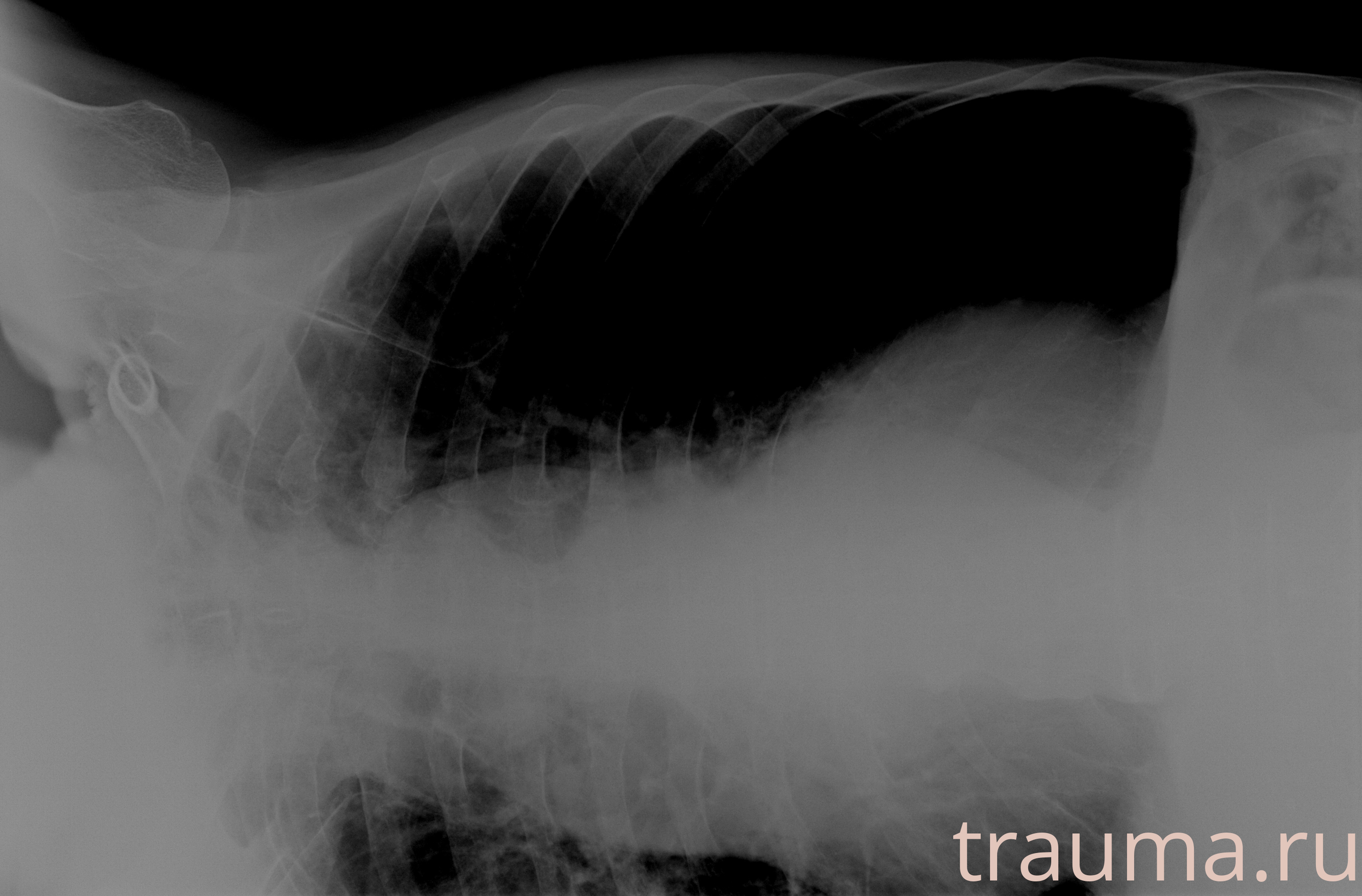 Рентген на дому: по вашему адресу приезжает врач-рентгенолог, травматолог-ортопед с мобильным рентгеновским аппаратом, проводит диагностику травмы или заболевания, делает необходимые рентгенограммы, дает рекомендации по дальнейшему лечению. Получить качественные снимки в домашних условиях возможно благодаря уникальной методике, разработанной МосРентген Центром для института  Склифосовского