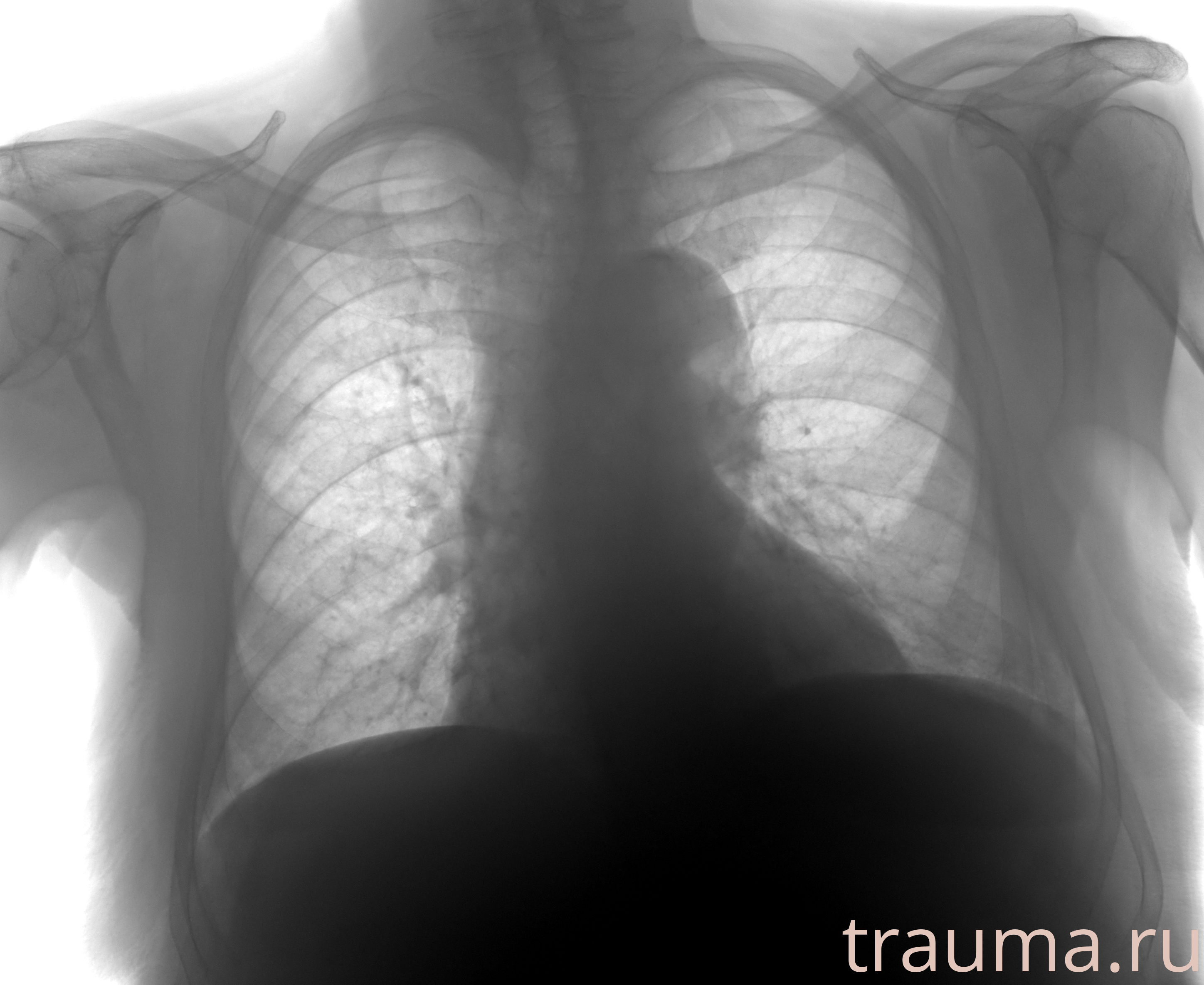 Рентген на дому: по вашему адресу приезжает врач-рентгенолог, травматолог-ортопед с мобильным рентгеновским аппаратом, проводит диагностику травмы или заболевания, делает необходимые рентгенограммы, дает рекомендации по дальнейшему лечению. Получить качественные снимки в домашних условиях возможно благодаря уникальной методике, разработанной МосРентген Центром для института  Склифосовского