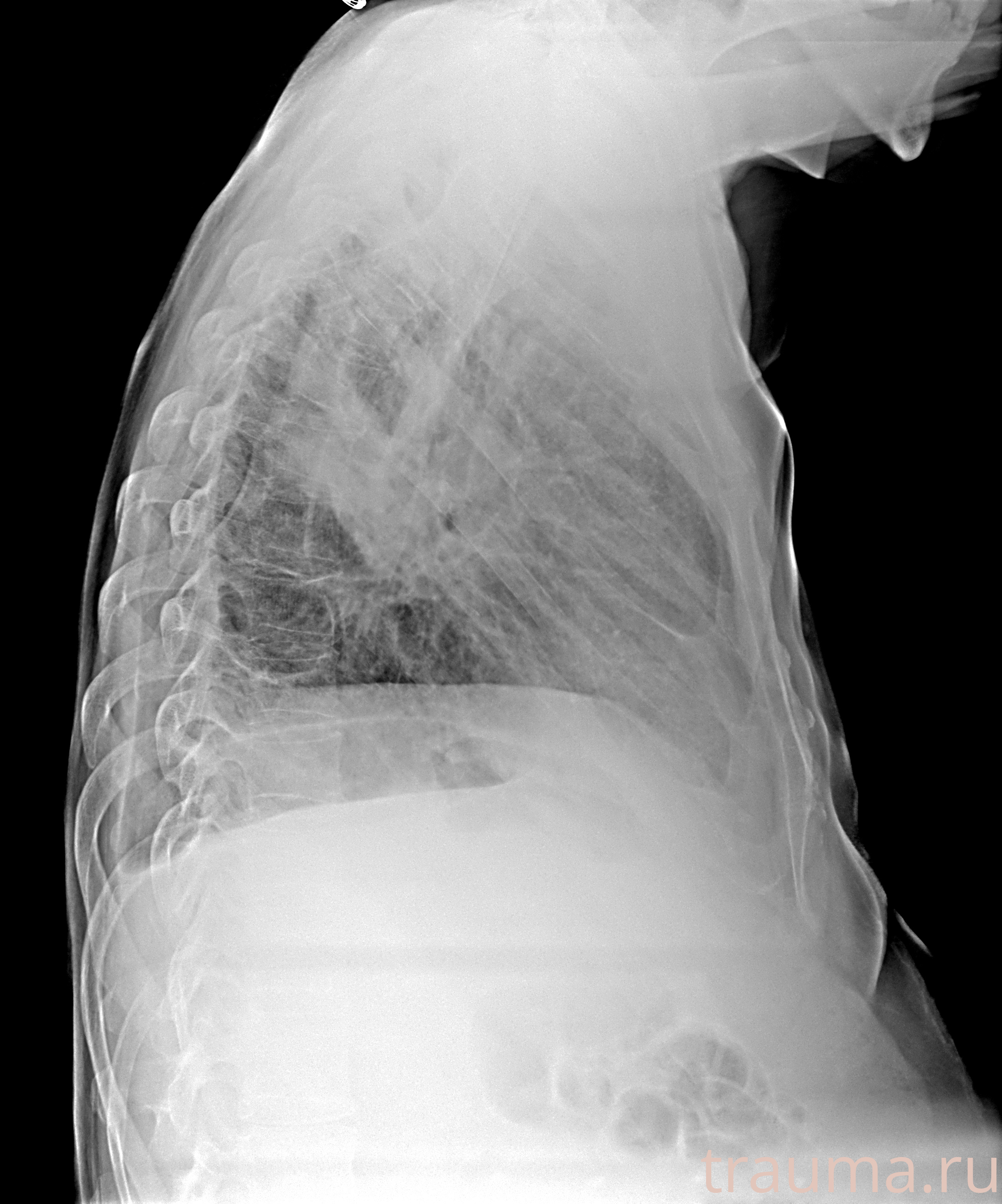 Рентген на дому: по вашему адресу приезжает врач-рентгенолог, травматолог-ортопед с мобильным рентгеновским аппаратом, проводит диагностику травмы или заболевания, делает необходимые рентгенограммы, дает рекомендации по дальнейшему лечению. Получить качественные снимки в домашних условиях возможно благодаря уникальной методике, разработанной МосРентген Центром для института  Склифосовского