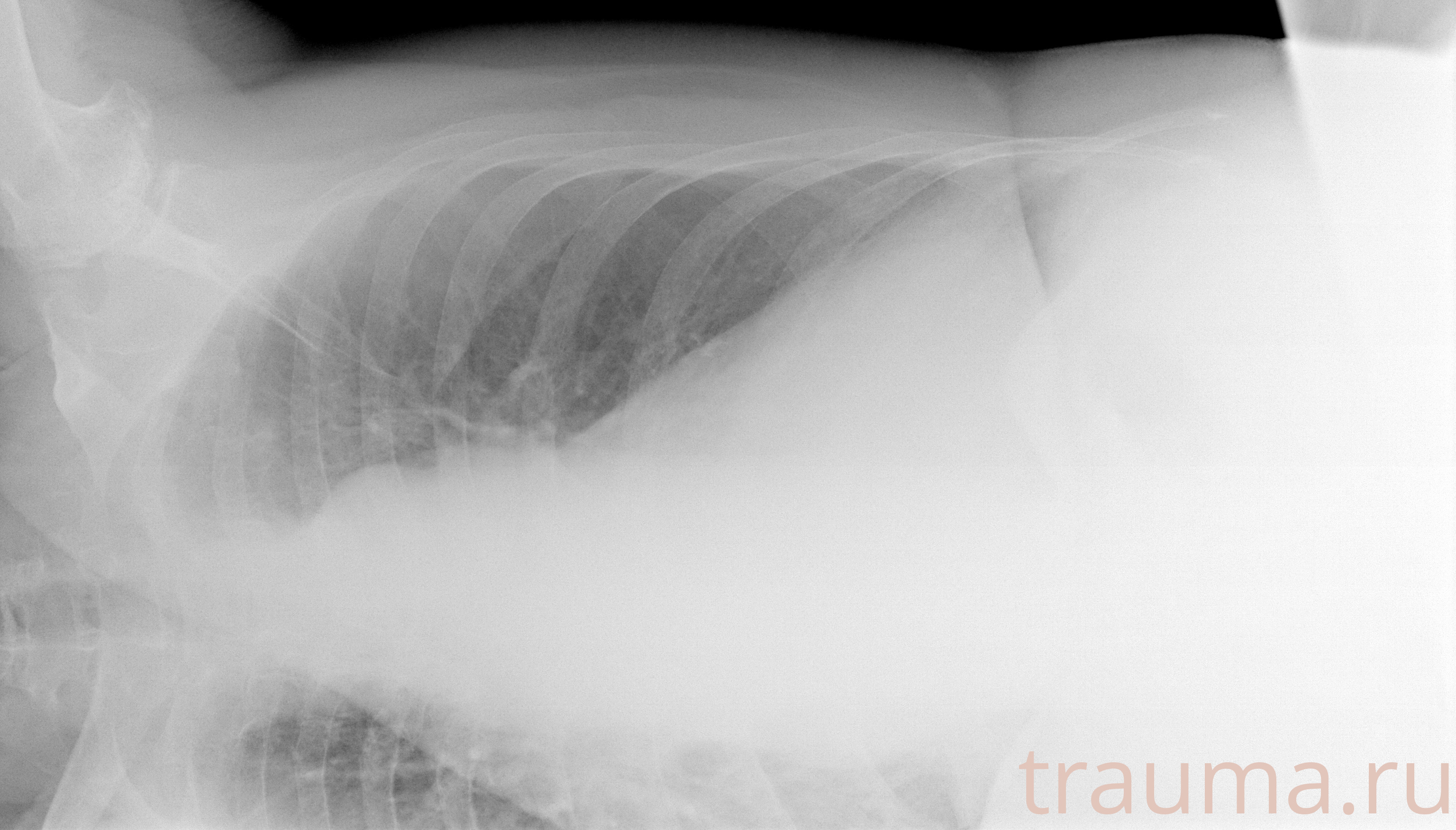 Рентген на дому: по вашему адресу приезжает врач-рентгенолог, травматолог-ортопед с мобильным рентгеновским аппаратом, проводит диагностику травмы или заболевания, делает необходимые рентгенограммы, дает рекомендации по дальнейшему лечению. Получить качественные снимки в домашних условиях возможно благодаря уникальной методике, разработанной МосРентген Центром для института  Склифосовского