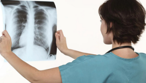 Рентгеноанатомические основы исследования легких. Рентгенологический анализ легких. Глава 26
