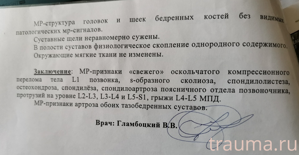 Рентген на дому: по вашему адресу приезжает врач-рентгенолог, травматолог-ортопед с мобильным рентгеновским аппаратом, проводит диагностику травмы или заболевания, делает необходимые рентгенограммы, дает рекомендации по дальнейшему лечению. Получить качественные снимки в домашних условиях возможно благодаря уникальной методике, разработанной МосРентген Центром для института  Склифосовского
