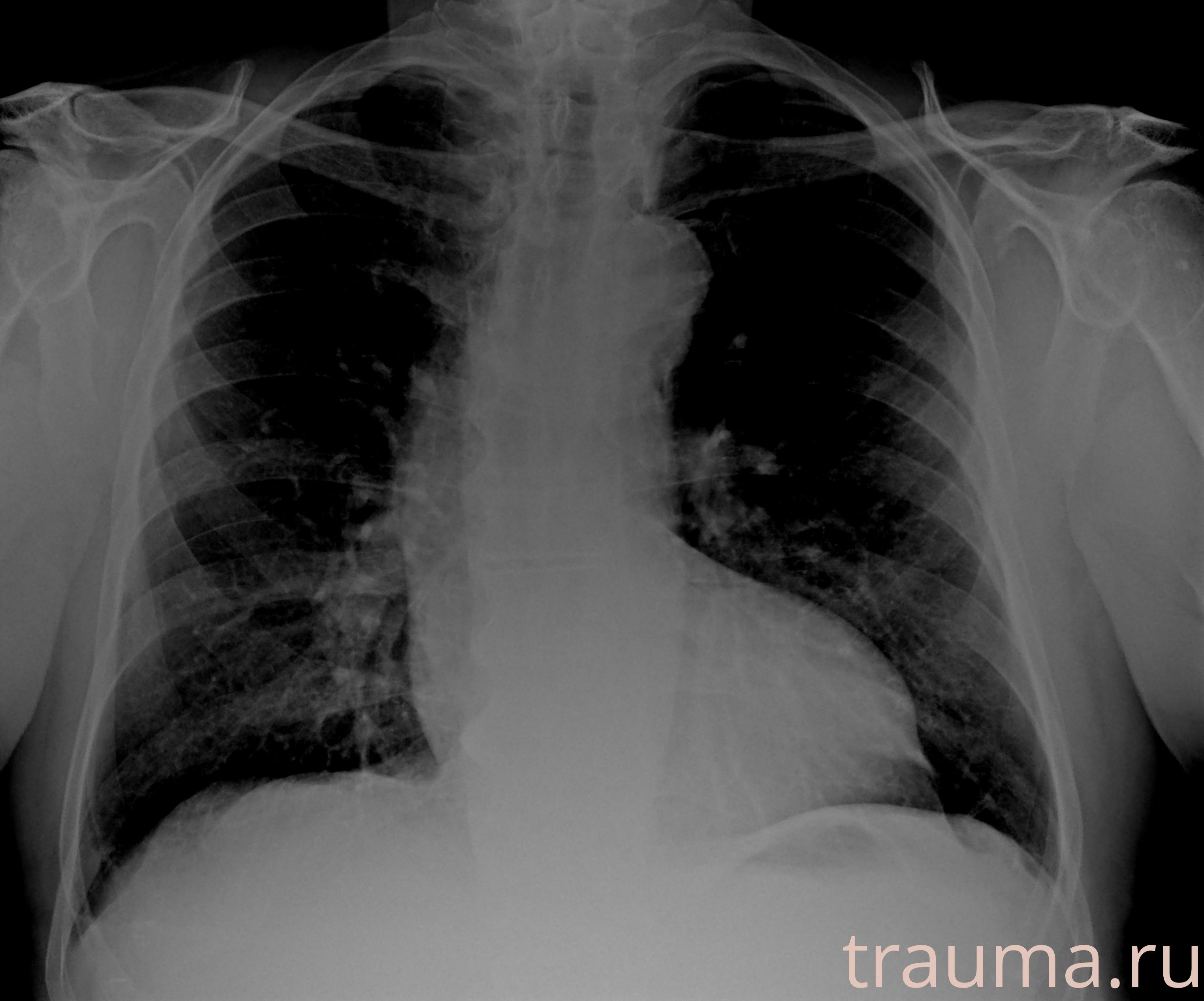 Рентген на дому: по вашему адресу приезжает врач-рентгенолог, травматолог-ортопед с мобильным рентгеновским аппаратом, проводит диагностику травмы или заболевания, делает необходимые рентгенограммы, дает рекомендации по дальнейшему лечению. Получить качественные снимки в домашних условиях возможно благодаря уникальной методике, разработанной МосРентген Центром для института  Склифосовского