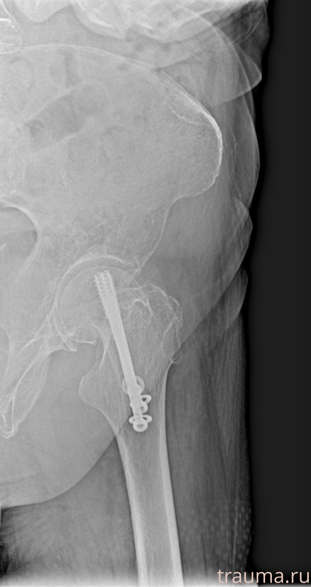 Рентген на дому: по вашему адресу приезжает врач-рентгенолог, травматолог-ортопед с мобильным рентгеновским аппаратом, проводит диагностику травмы или заболевания, делает необходимые рентгенограммы, дает рекомендации по дальнейшему лечению. Получить качественные снимки в домашних условиях возможно благодаря уникальной методике, разработанной МосРентген Центром для института  Склифосовского