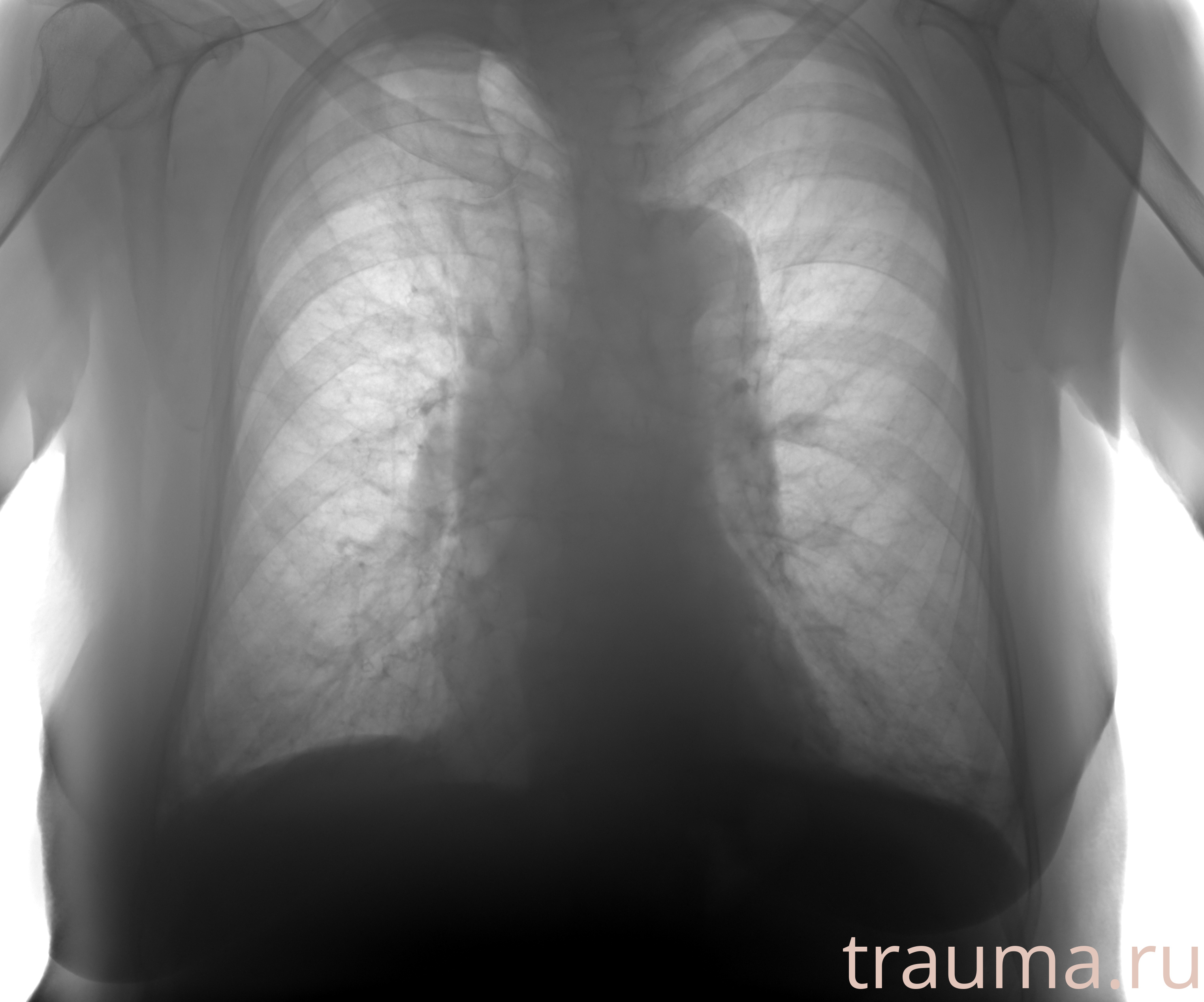 Рентген на дому: по вашему адресу приезжает врач-рентгенолог, травматолог-ортопед с мобильным рентгеновским аппаратом, проводит диагностику травмы или заболевания, делает необходимые рентгенограммы, дает рекомендации по дальнейшему лечению. Получить качественные снимки в домашних условиях возможно благодаря уникальной методике, разработанной МосРентген Центром для института  Склифосовского