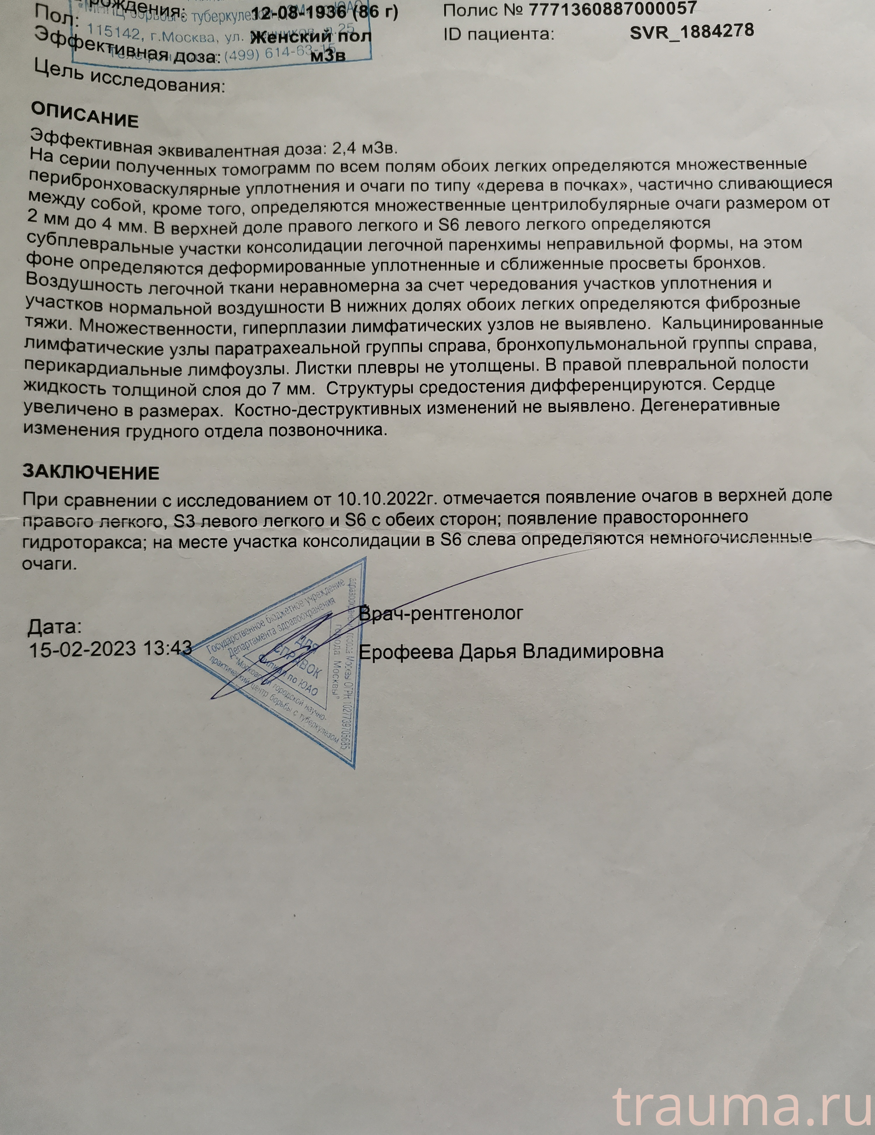 Рентген на дому: по вашему адресу приезжает врач-рентгенолог, травматолог-ортопед с мобильным рентгеновским аппаратом, проводит диагностику травмы или заболевания, делает необходимые рентгенограммы, дает рекомендации по дальнейшему лечению. Получить качественные снимки в домашних условиях возможно благодаря уникальной методике, разработанной МосРентген Центром для института  Склифосовского