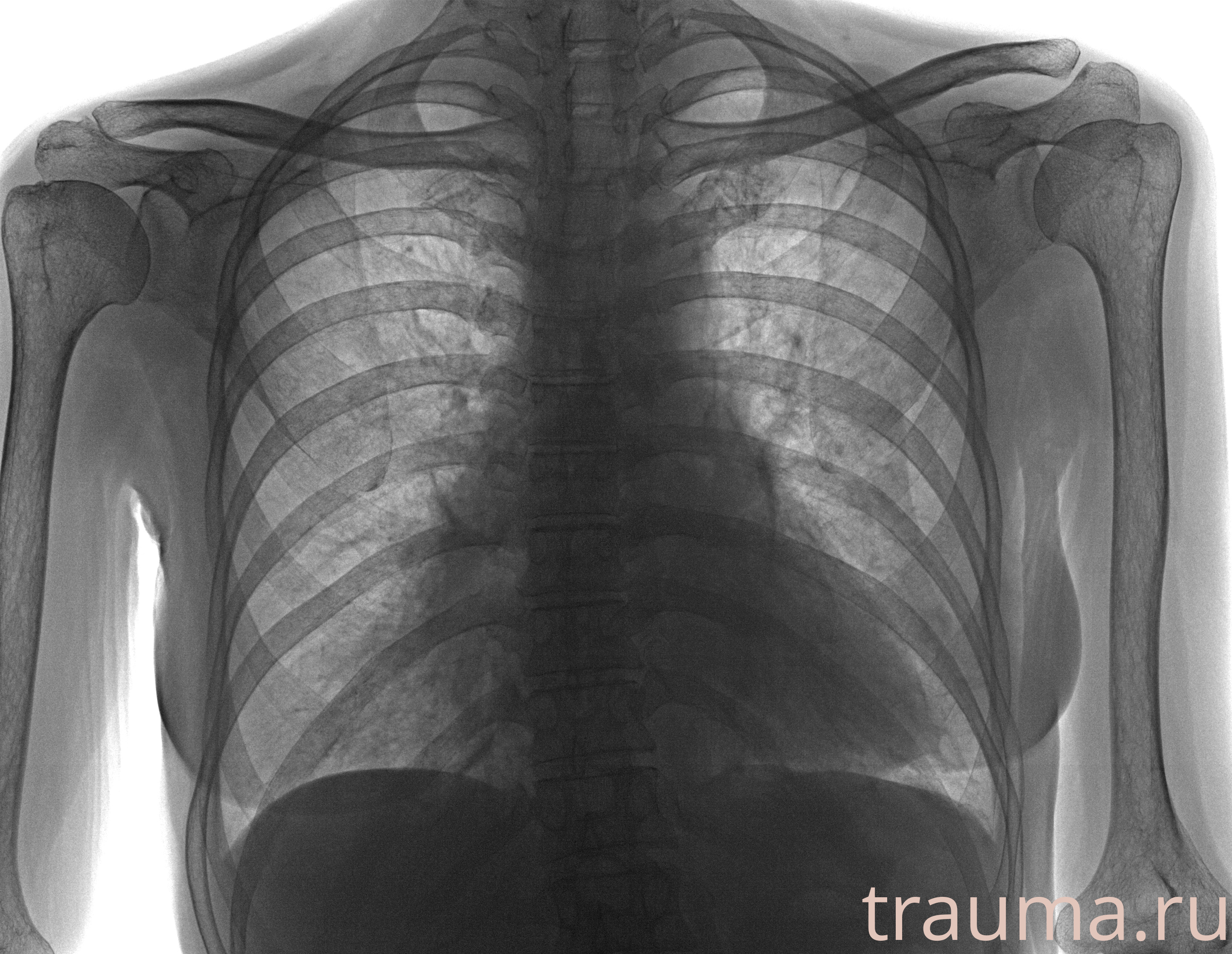 Рентген на дому: по вашему адресу приезжает врач-рентгенолог, травматолог-ортопед с мобильным рентгеновским аппаратом, проводит диагностику травмы или заболевания, делает необходимые рентгенограммы, дает рекомендации по дальнейшему лечению. Получить качественные снимки в домашних условиях возможно благодаря уникальной методике, разработанной МосРентген Центром для института  Склифосовского