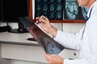 Рентгенологическая картина заживления "спицевых" дефектов кости и их влияние на пульсовое кровенаполнение сосудов полости диафиза