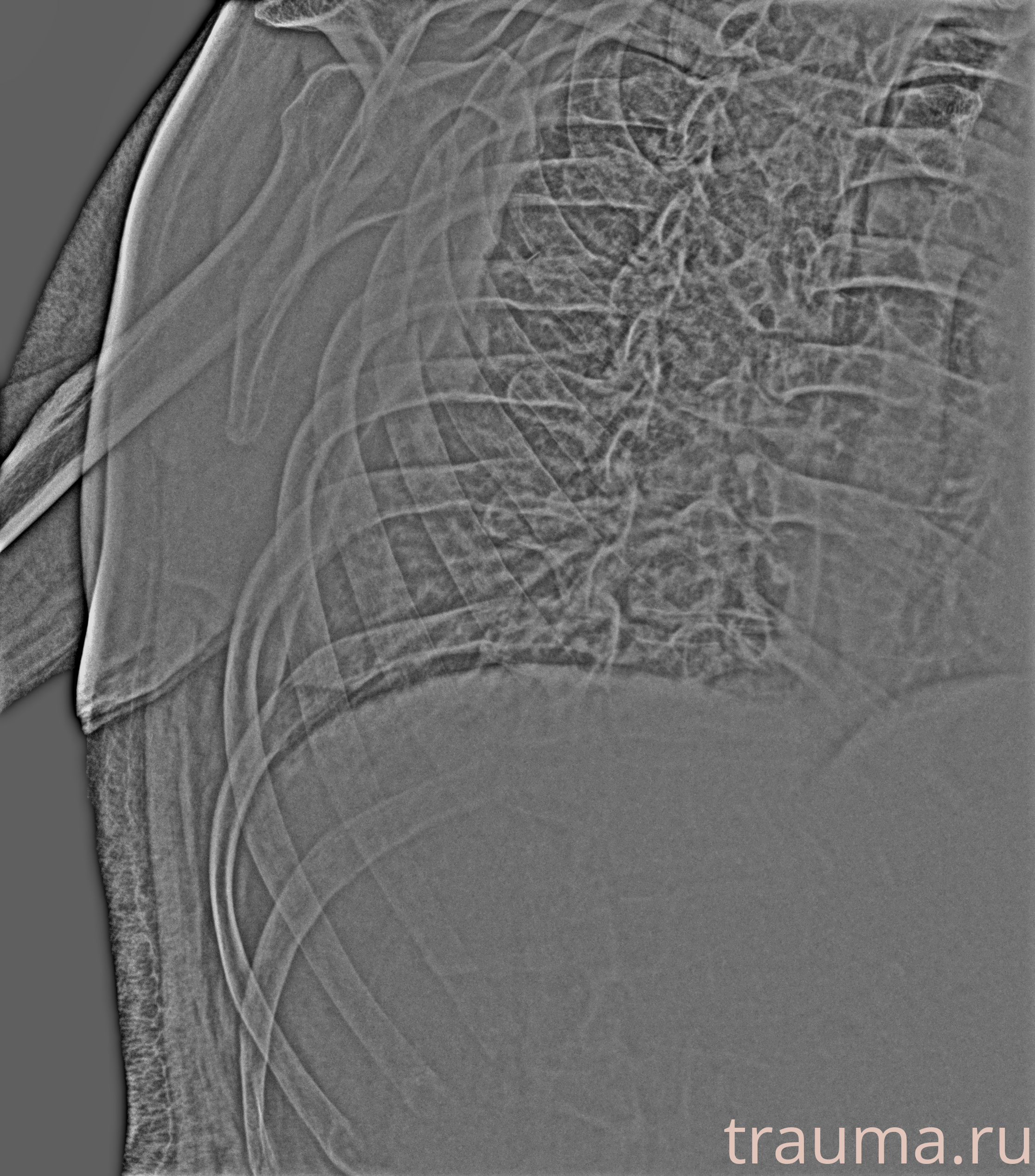 Рентген на дому: по вашему адресу приезжает врач-рентгенолог, травматолог-ортопед с мобильным рентгеновским аппаратом, проводит диагностику травмы или заболевания, делает необходимые рентгенограммы, дает рекомендации по дальнейшему лечению. Получить качественные снимки в домашних условиях возможно благодаря уникальной методике, разработанной МосРентген Центром для института  Склифосовского