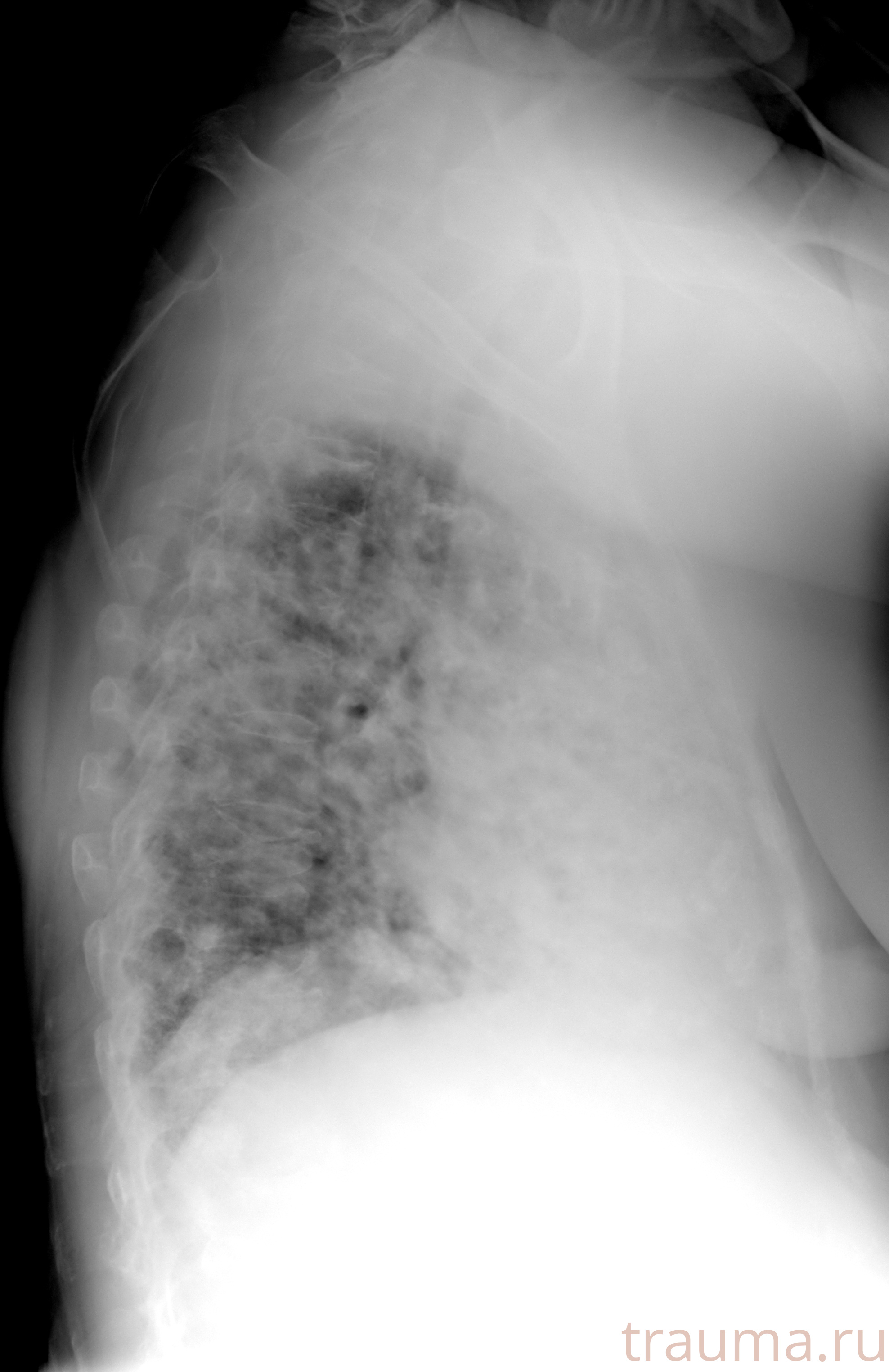 Рентген на дому: по вашему адресу приезжает врач-рентгенолог, травматолог-ортопед с мобильным рентгеновским аппаратом, проводит диагностику травмы или заболевания, делает необходимые рентгенограммы, дает рекомендации по дальнейшему лечению. Получить качественные снимки в домашних условиях возможно благодаря уникальной методике, разработанной МосРентген Центром для института  Склифосовского