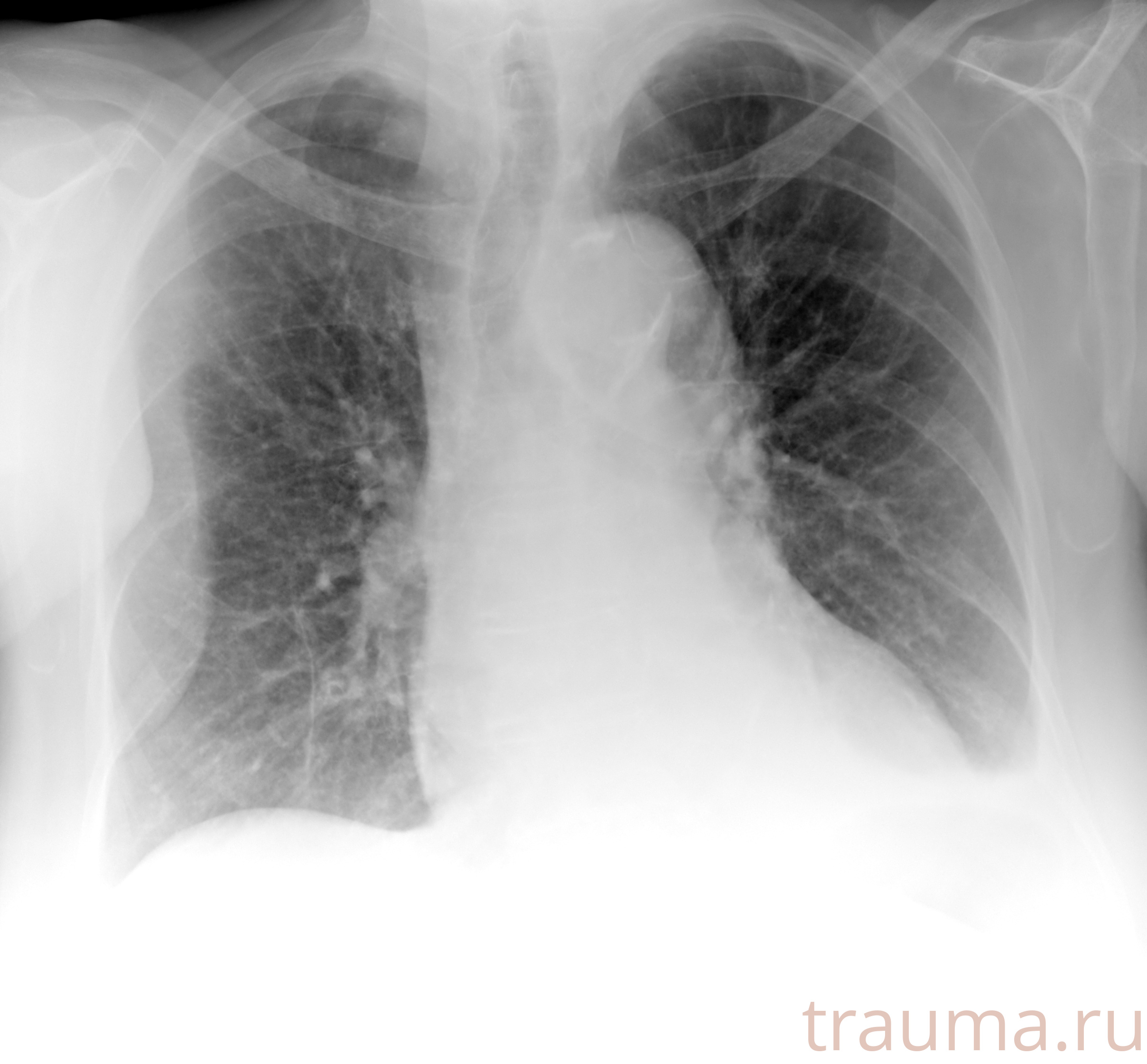 Рентген на дому: по вашему адресу приезжает врач-рентгенолог, травматолог-ортопед с мобильным рентгеновским аппаратом, проводит диагностику травмы или заболевания, делает необходимые рентгенограммы, дает рекомендации по дальнейшему лечению. Получить качественные снимки в домашних условиях возможно благодаря уникальной методике, разработанной МосРентген Центром для института  Склифосовского