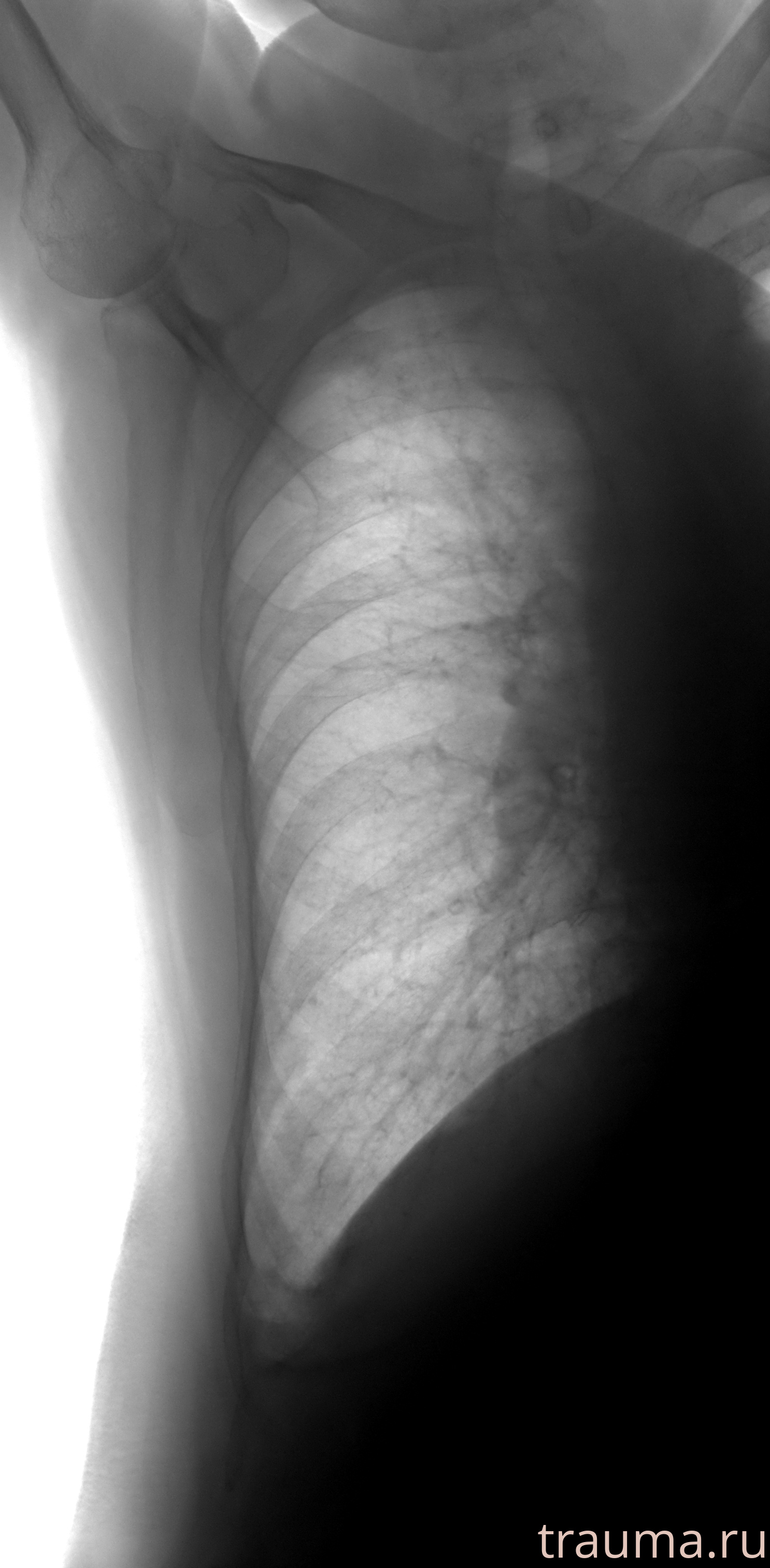 Рентген на дому: по вашему адресу приезжает врач-рентгенолог, травматолог-ортопед с мобильным рентгеновским аппаратом, проводит диагностику травмы или заболевания, делает необходимые рентгенограммы, дает рекомендации по дальнейшему лечению. Получить качественные снимки в домашних условиях возможно благодаря уникальной методике, разработанной МосРентген Центром для института  Склифосовского