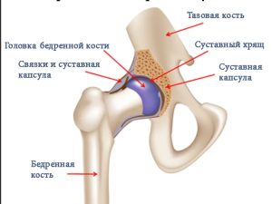 Определение конгруэнтности стандартного полусферического вертлужного компонента и посттравматически деформированной вертлужной впадины при первичном эндопротезировании тазобедренного сустава (экспериментальное исследование)