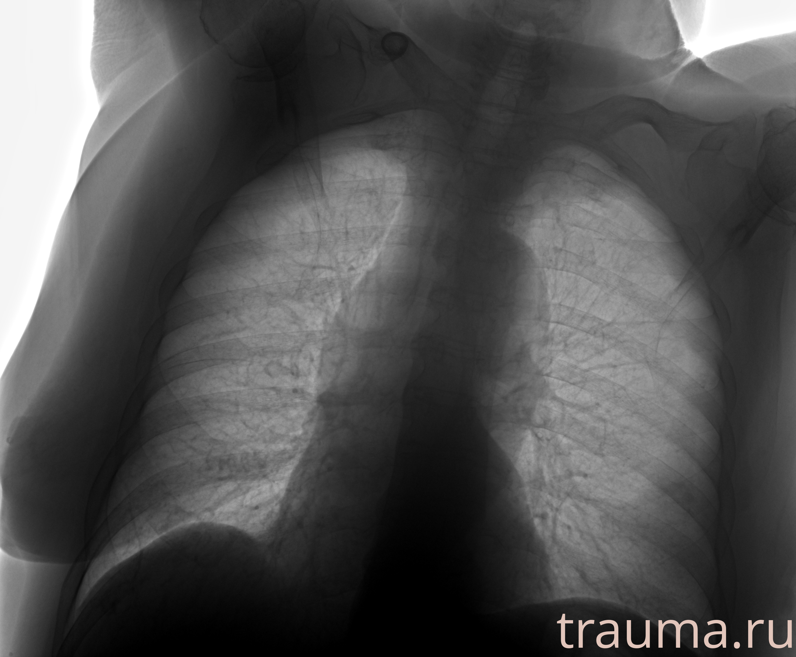 Рентген на дому: по вашему адресу приезжает врач-рентгенолог, травматолог-ортопед с мобильным рентгеновским аппаратом, проводит диагностику травмы или заболевания, делает необходимые рентгенограммы, дает рекомендации по дальнейшему лечению. Получить качественные снимки в домашних условиях возможно благодаря уникальной методике, разработанной МосРентген Центром для института  Склифосовского