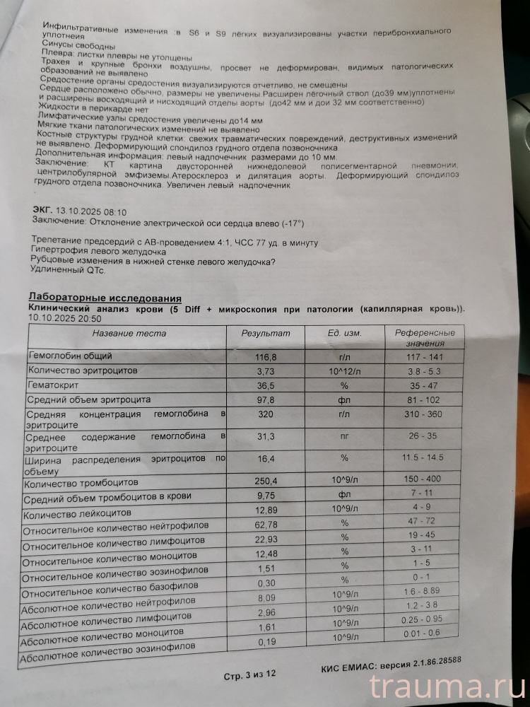 Рентген на дому: по вашему адресу приезжает врач-рентгенолог, травматолог-ортопед с мобильным рентгеновским аппаратом, проводит диагностику травмы или заболевания, делает необходимые рентгенограммы, дает рекомендации по дальнейшему лечению. Получить качественные снимки в домашних условиях возможно благодаря уникальной методике, разработанной МосРентген Центром для института  Склифосовского