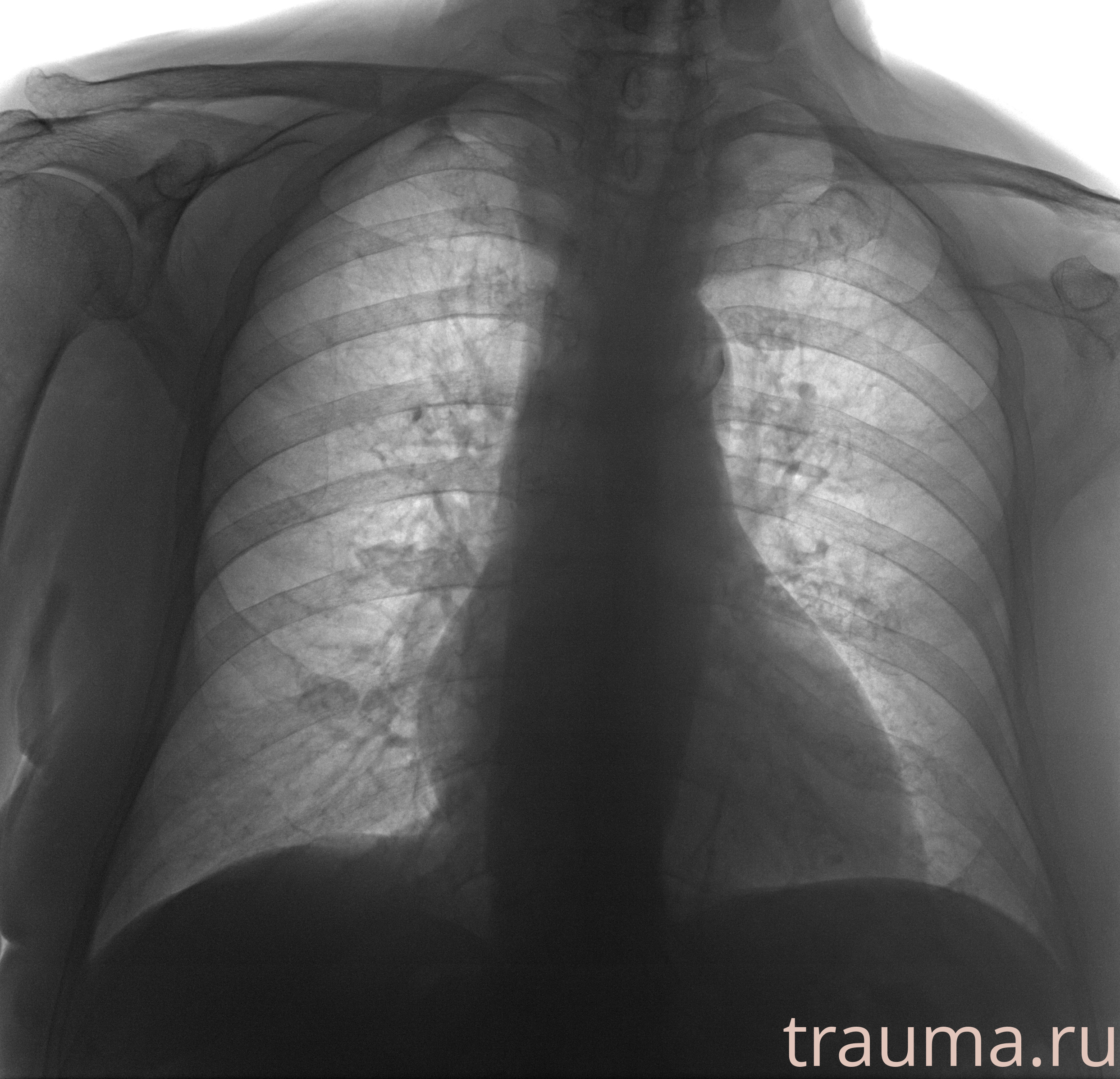 Рентген на дому: по вашему адресу приезжает врач-рентгенолог, травматолог-ортопед с мобильным рентгеновским аппаратом, проводит диагностику травмы или заболевания, делает необходимые рентгенограммы, дает рекомендации по дальнейшему лечению. Получить качественные снимки в домашних условиях возможно благодаря уникальной методике, разработанной МосРентген Центром для института  Склифосовского