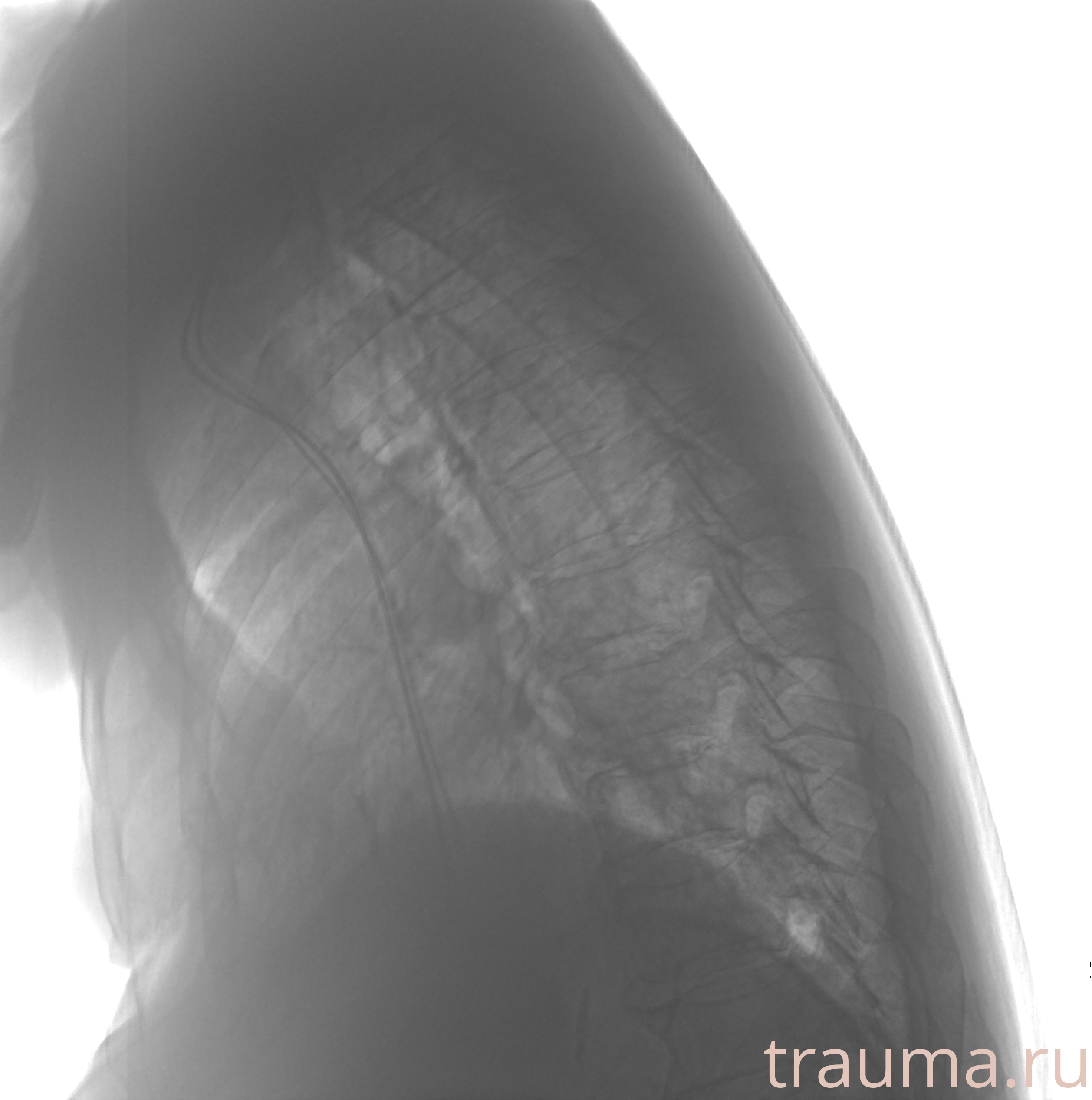 Рентген на дому: по вашему адресу приезжает врач-рентгенолог, травматолог-ортопед с мобильным рентгеновским аппаратом, проводит диагностику травмы или заболевания, делает необходимые рентгенограммы, дает рекомендации по дальнейшему лечению. Получить качественные снимки в домашних условиях возможно благодаря уникальной методике, разработанной МосРентген Центром для института  Склифосовского