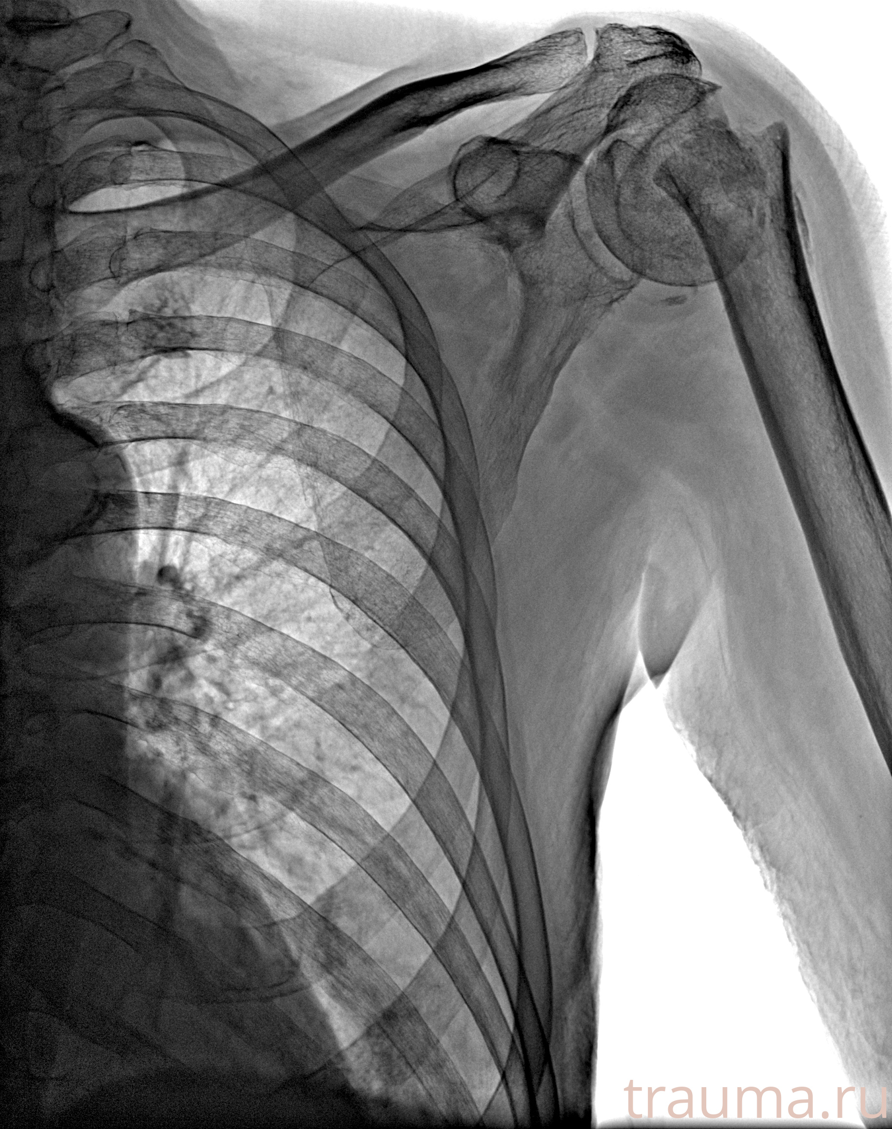 Рентген на дому: по вашему адресу приезжает врач-рентгенолог, травматолог-ортопед с мобильным рентгеновским аппаратом, проводит диагностику травмы или заболевания, делает необходимые рентгенограммы, дает рекомендации по дальнейшему лечению. Получить качественные снимки в домашних условиях возможно благодаря уникальной методике, разработанной МосРентген Центром для института  Склифосовского