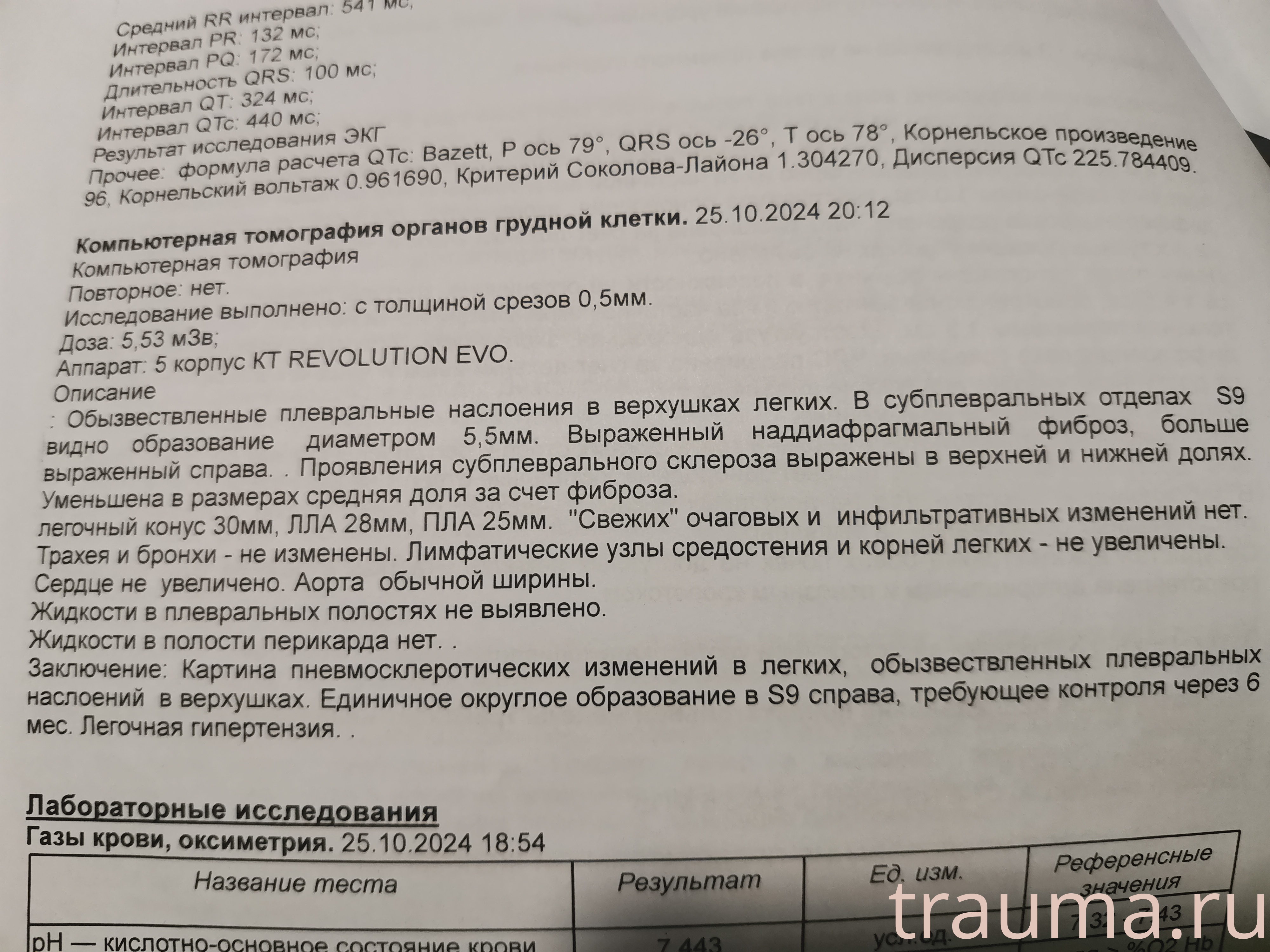 Рентген на дому: по вашему адресу приезжает врач-рентгенолог, травматолог-ортопед с мобильным рентгеновским аппаратом, проводит диагностику травмы или заболевания, делает необходимые рентгенограммы, дает рекомендации по дальнейшему лечению. Получить качественные снимки в домашних условиях возможно благодаря уникальной методике, разработанной МосРентген Центром для института  Склифосовского