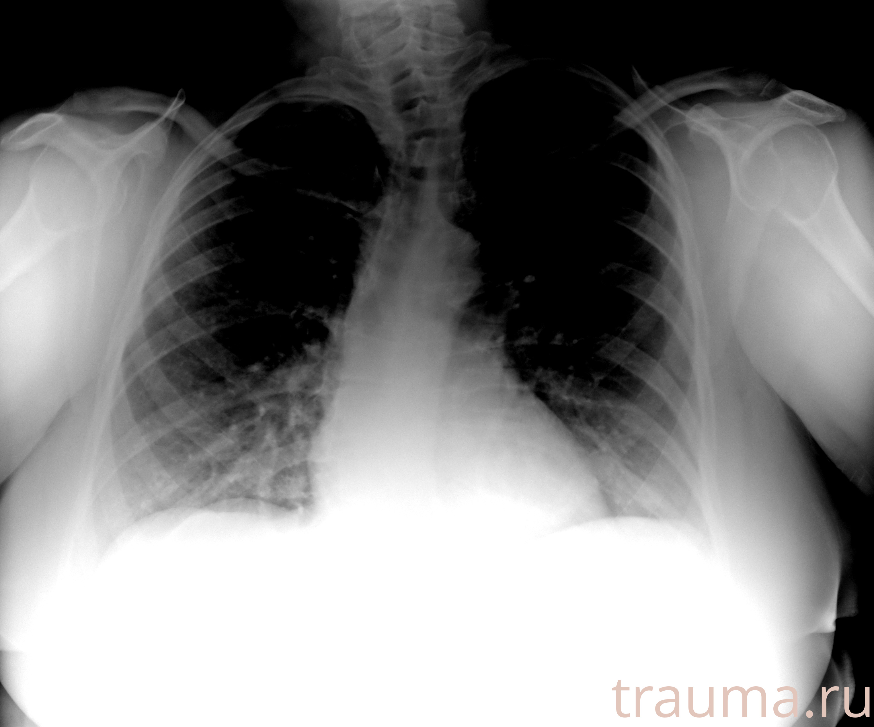 Рентген на дому: по вашему адресу приезжает врач-рентгенолог, травматолог-ортопед с мобильным рентгеновским аппаратом, проводит диагностику травмы или заболевания, делает необходимые рентгенограммы, дает рекомендации по дальнейшему лечению. Получить качественные снимки в домашних условиях возможно благодаря уникальной методике, разработанной МосРентген Центром для института  Склифосовского