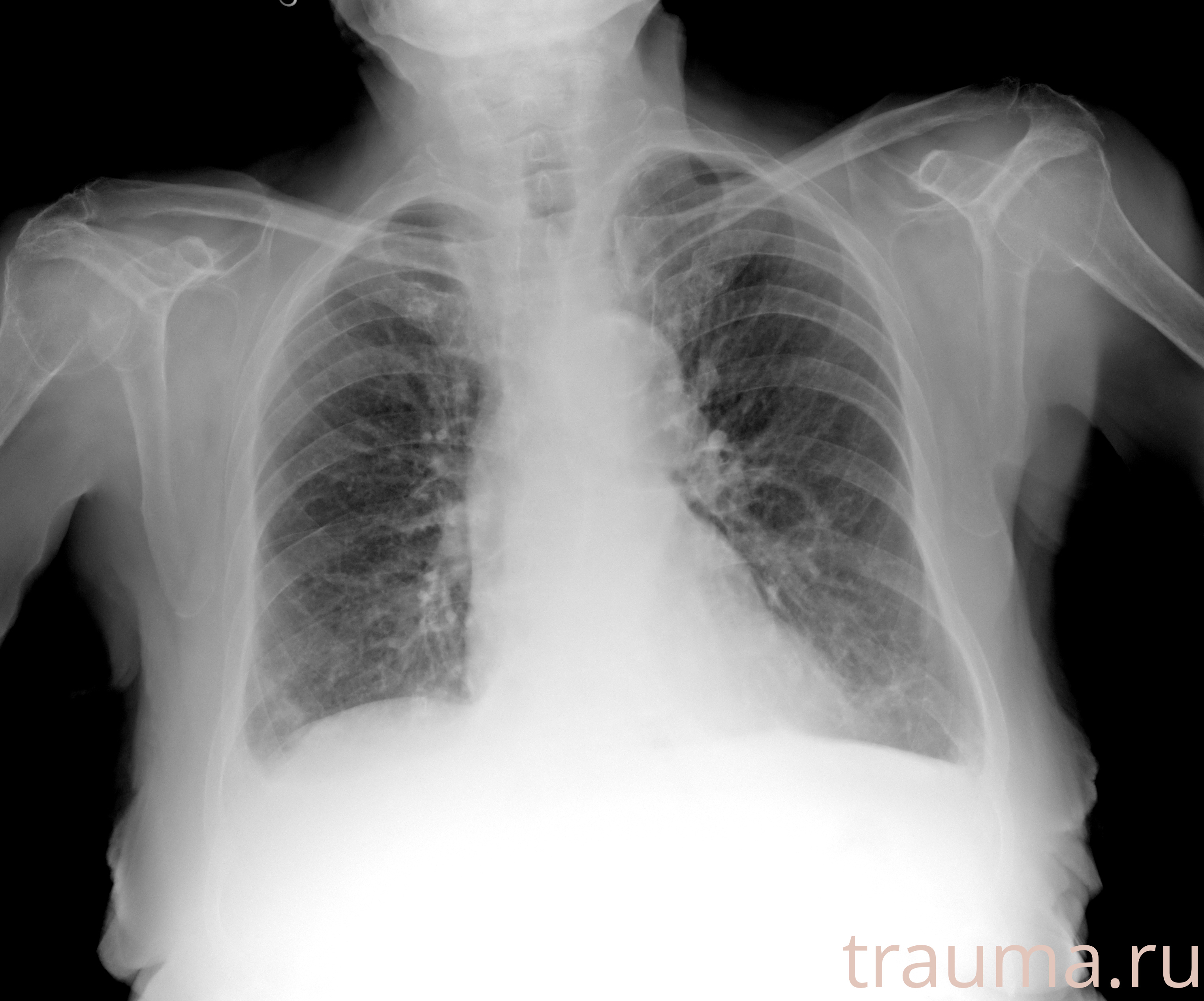 Рентген на дому: по вашему адресу приезжает врач-рентгенолог, травматолог-ортопед с мобильным рентгеновским аппаратом, проводит диагностику травмы или заболевания, делает необходимые рентгенограммы, дает рекомендации по дальнейшему лечению. Получить качественные снимки в домашних условиях возможно благодаря уникальной методике, разработанной МосРентген Центром для института  Склифосовского