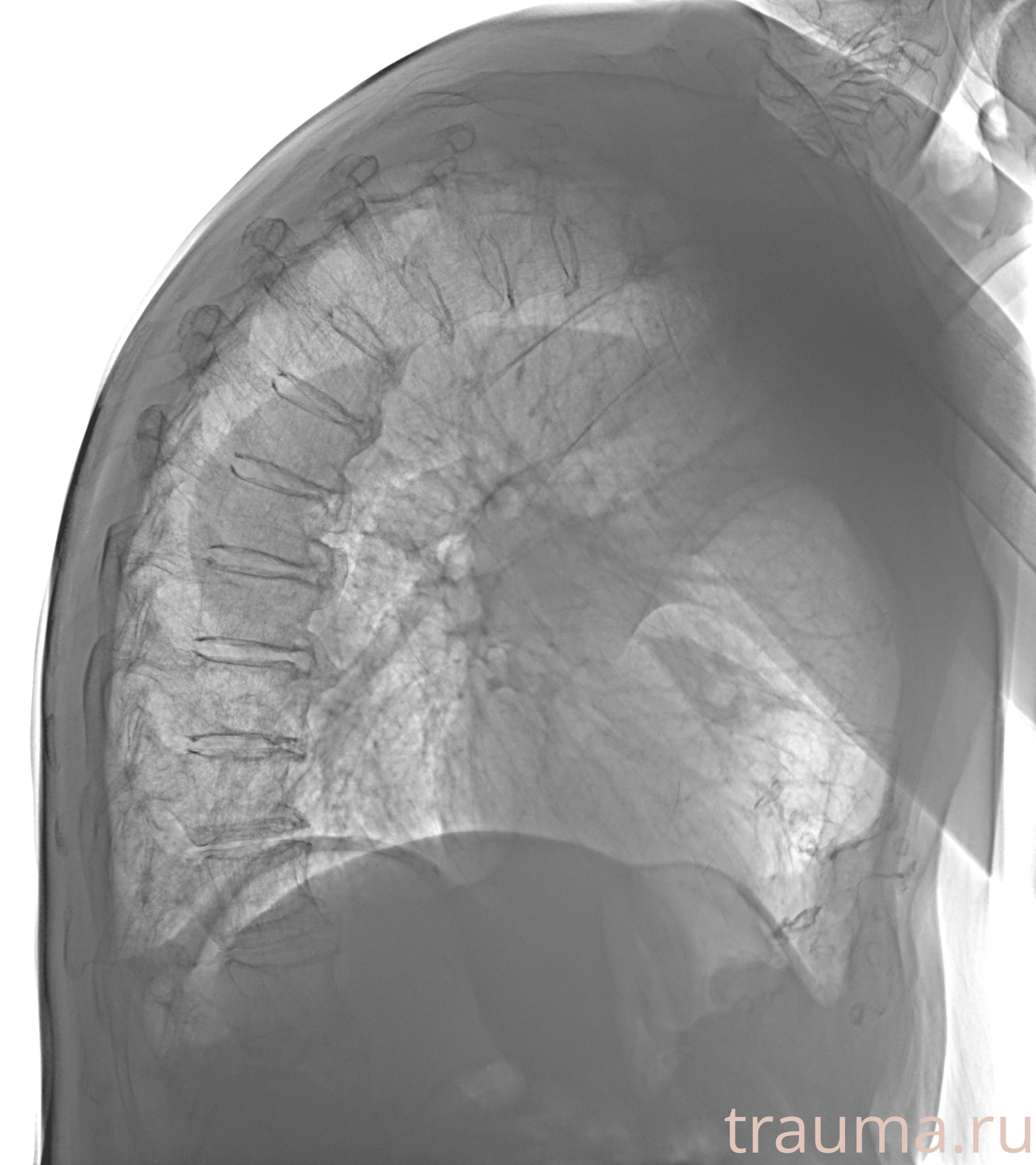 Рентген на дому: по вашему адресу приезжает врач-рентгенолог, травматолог-ортопед с мобильным рентгеновским аппаратом, проводит диагностику травмы или заболевания, делает необходимые рентгенограммы, дает рекомендации по дальнейшему лечению. Получить качественные снимки в домашних условиях возможно благодаря уникальной методике, разработанной МосРентген Центром для института  Склифосовского