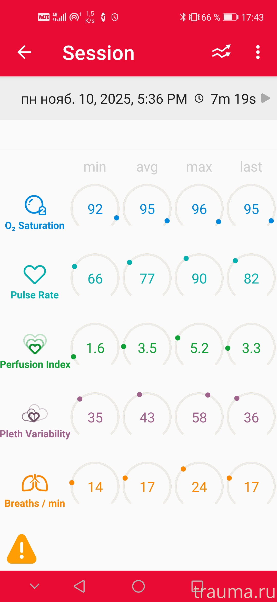 Рентген на дому: по вашему адресу приезжает врач-рентгенолог, травматолог-ортопед с мобильным рентгеновским аппаратом, проводит диагностику травмы или заболевания, делает необходимые рентгенограммы, дает рекомендации по дальнейшему лечению. Получить качественные снимки в домашних условиях возможно благодаря уникальной методике, разработанной МосРентген Центром для института  Склифосовского