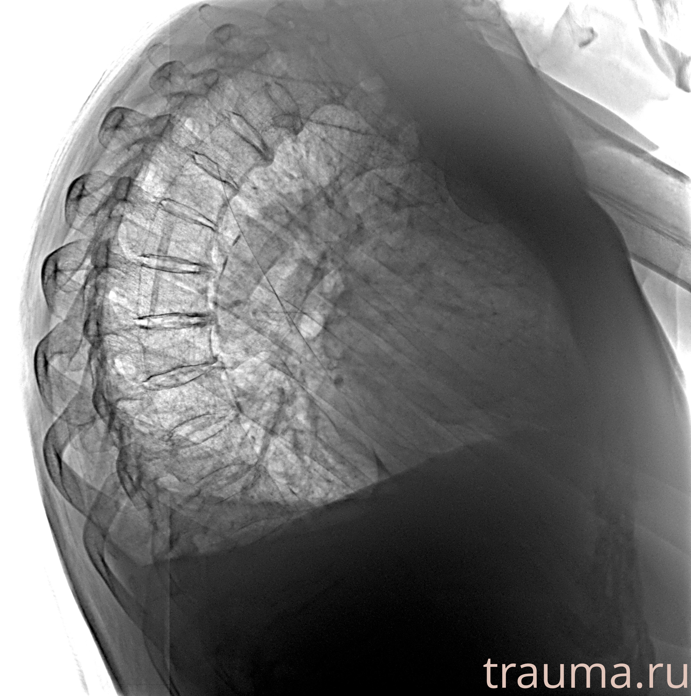 Рентген на дому: по вашему адресу приезжает врач-рентгенолог, травматолог-ортопед с мобильным рентгеновским аппаратом, проводит диагностику травмы или заболевания, делает необходимые рентгенограммы, дает рекомендации по дальнейшему лечению. Получить качественные снимки в домашних условиях возможно благодаря уникальной методике, разработанной МосРентген Центром для института  Склифосовского