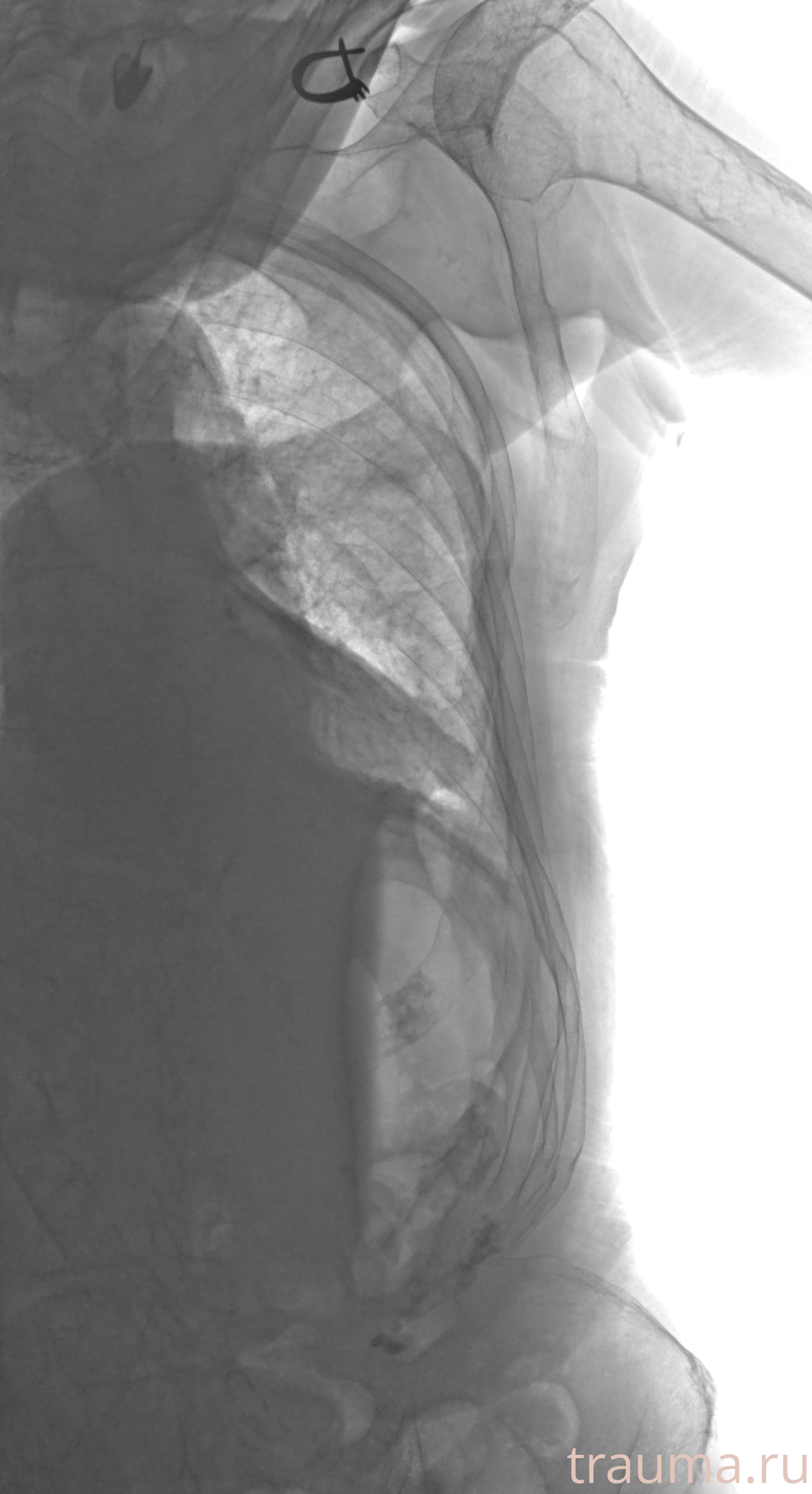 Рентген на дому: по вашему адресу приезжает врач-рентгенолог, травматолог-ортопед с мобильным рентгеновским аппаратом, проводит диагностику травмы или заболевания, делает необходимые рентгенограммы, дает рекомендации по дальнейшему лечению. Получить качественные снимки в домашних условиях возможно благодаря уникальной методике, разработанной МосРентген Центром для института  Склифосовского