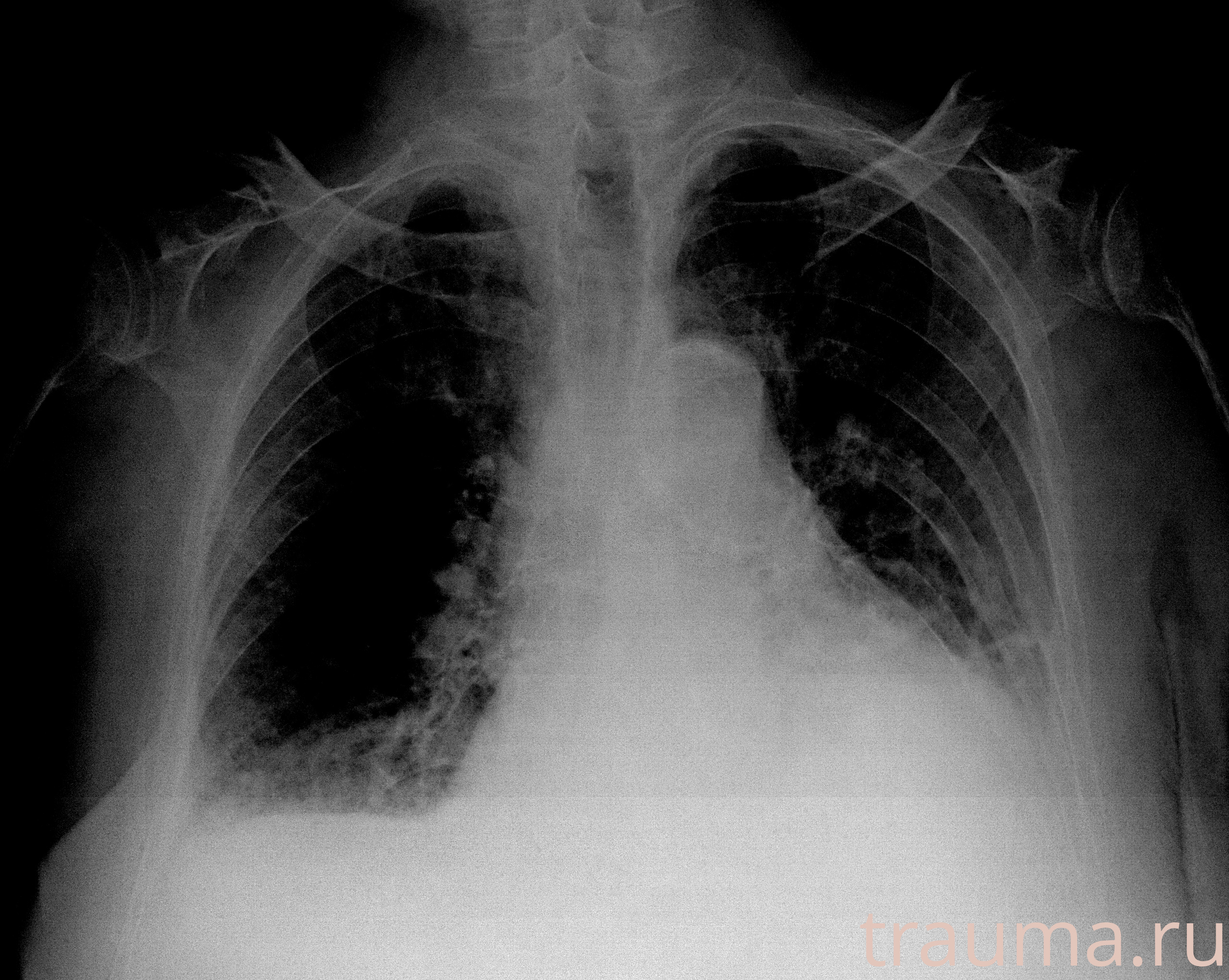 Рентген на дому: по вашему адресу приезжает врач-рентгенолог, травматолог-ортопед с мобильным рентгеновским аппаратом, проводит диагностику травмы или заболевания, делает необходимые рентгенограммы, дает рекомендации по дальнейшему лечению. Получить качественные снимки в домашних условиях возможно благодаря уникальной методике, разработанной МосРентген Центром для института  Склифосовского