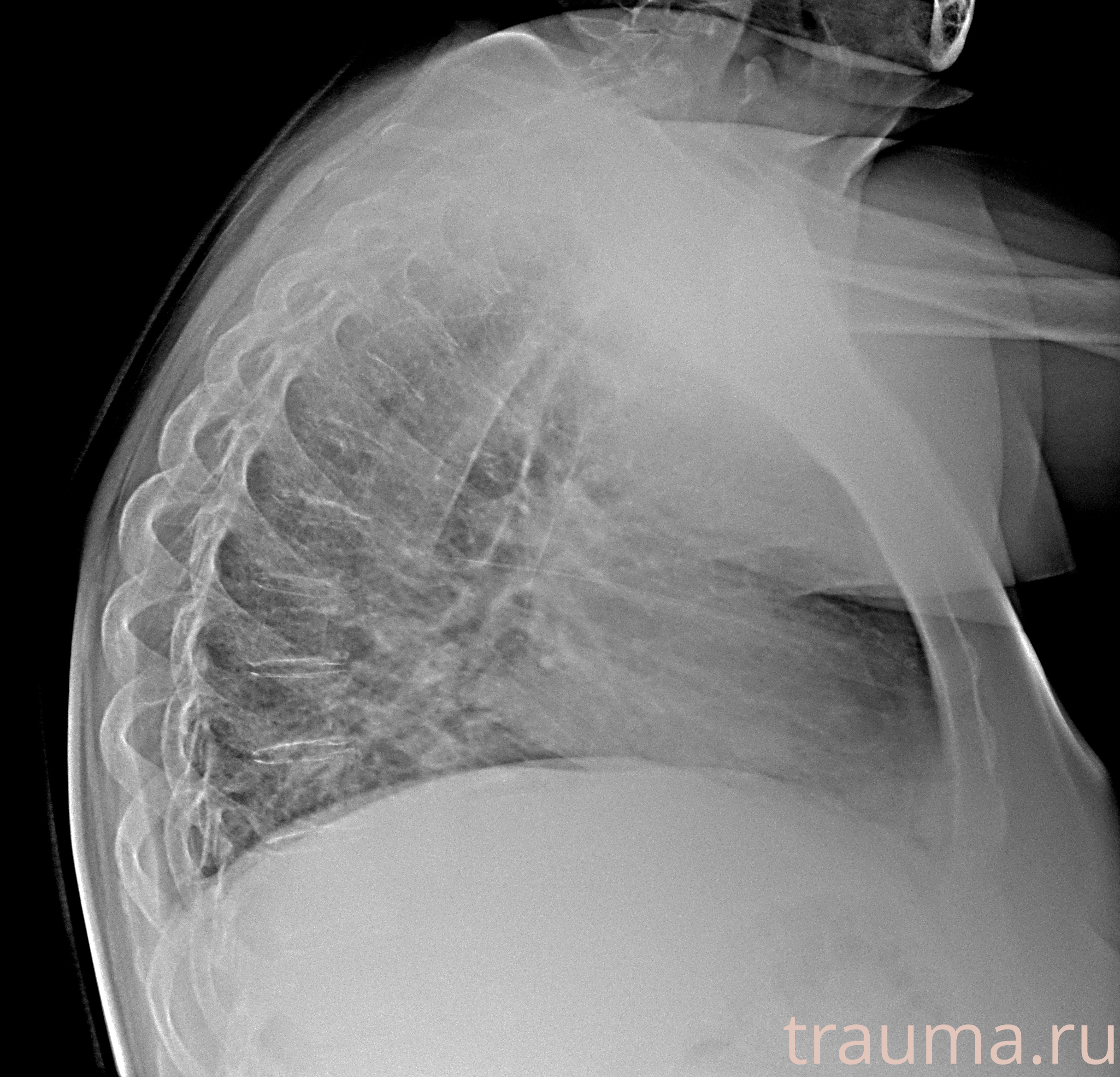 Рентген на дому: по вашему адресу приезжает врач-рентгенолог, травматолог-ортопед с мобильным рентгеновским аппаратом, проводит диагностику травмы или заболевания, делает необходимые рентгенограммы, дает рекомендации по дальнейшему лечению. Получить качественные снимки в домашних условиях возможно благодаря уникальной методике, разработанной МосРентген Центром для института  Склифосовского