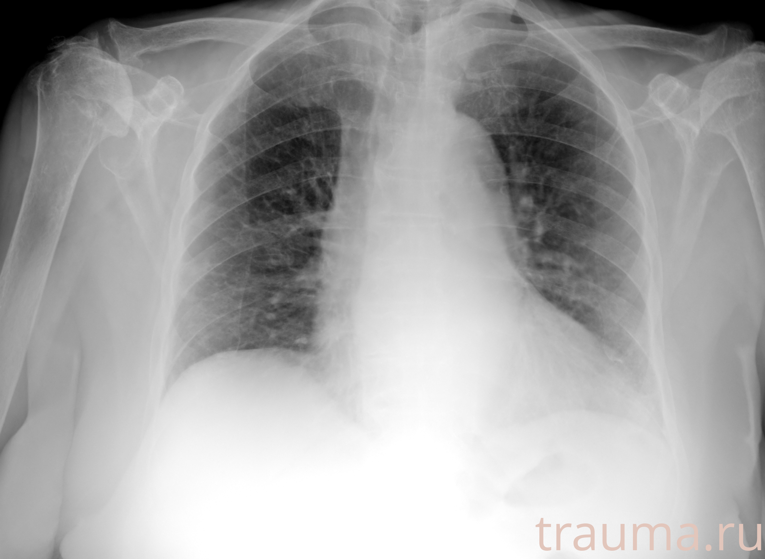 Рентген на дому: по вашему адресу приезжает врач-рентгенолог, травматолог-ортопед с мобильным рентгеновским аппаратом, проводит диагностику травмы или заболевания, делает необходимые рентгенограммы, дает рекомендации по дальнейшему лечению. Получить качественные снимки в домашних условиях возможно благодаря уникальной методике, разработанной МосРентген Центром для института  Склифосовского