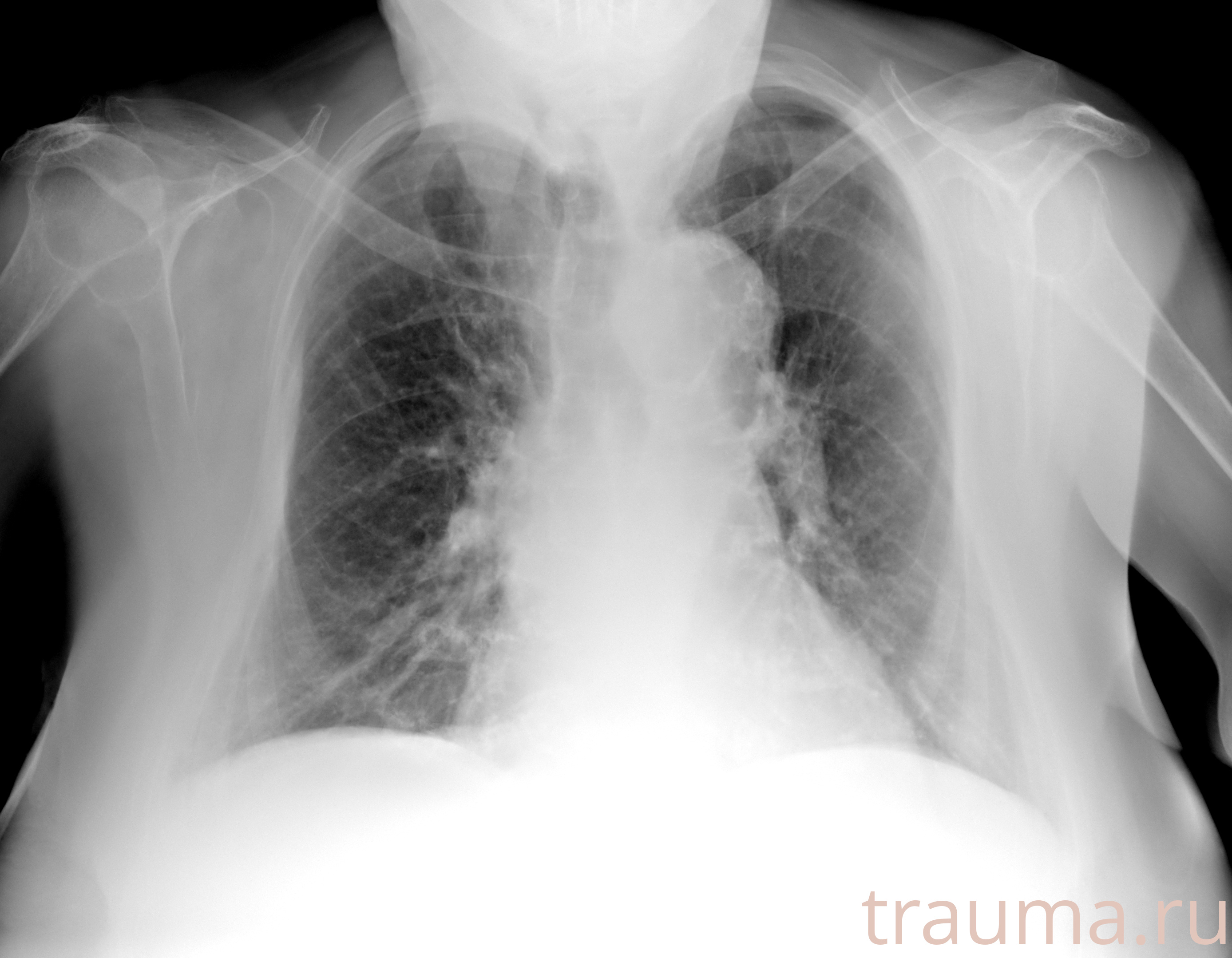 Рентген на дому: по вашему адресу приезжает врач-рентгенолог, травматолог-ортопед с мобильным рентгеновским аппаратом, проводит диагностику травмы или заболевания, делает необходимые рентгенограммы, дает рекомендации по дальнейшему лечению. Получить качественные снимки в домашних условиях возможно благодаря уникальной методике, разработанной МосРентген Центром для института  Склифосовского