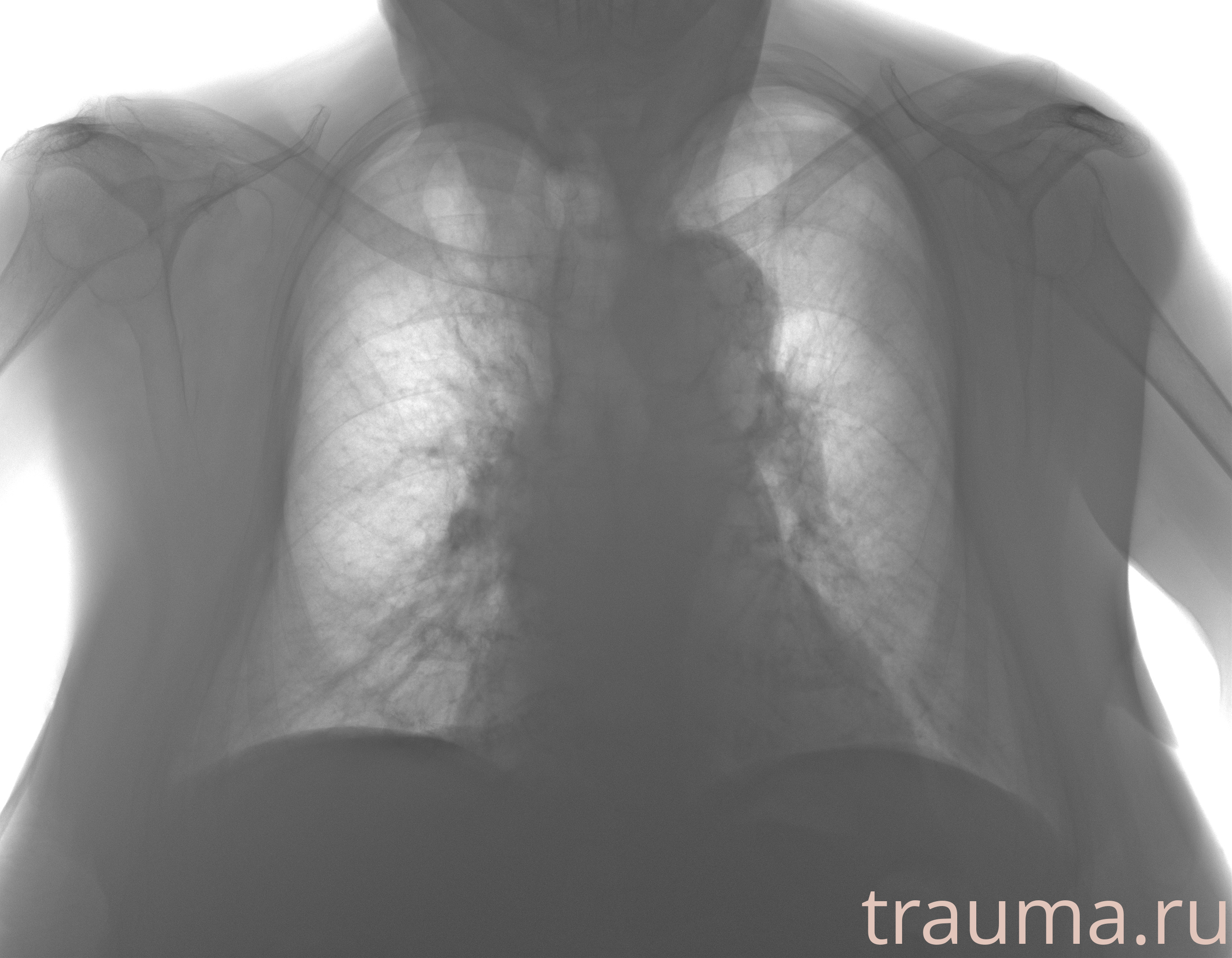 Рентген на дому: по вашему адресу приезжает врач-рентгенолог, травматолог-ортопед с мобильным рентгеновским аппаратом, проводит диагностику травмы или заболевания, делает необходимые рентгенограммы, дает рекомендации по дальнейшему лечению. Получить качественные снимки в домашних условиях возможно благодаря уникальной методике, разработанной МосРентген Центром для института  Склифосовского