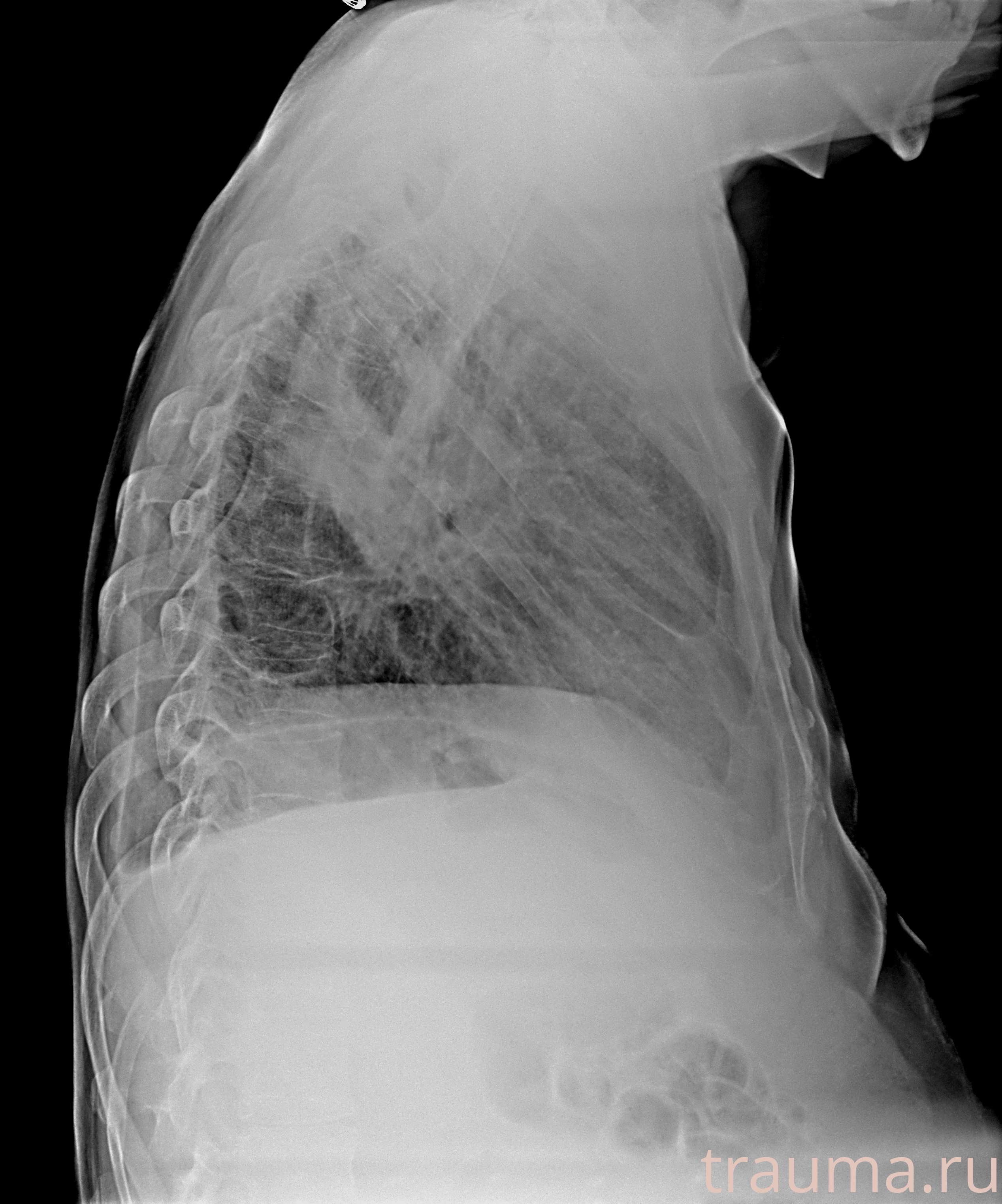 Рентген на дому: по вашему адресу приезжает врач-рентгенолог, травматолог-ортопед с мобильным рентгеновским аппаратом, проводит диагностику травмы или заболевания, делает необходимые рентгенограммы, дает рекомендации по дальнейшему лечению. Получить качественные снимки в домашних условиях возможно благодаря уникальной методике, разработанной МосРентген Центром для института  Склифосовского