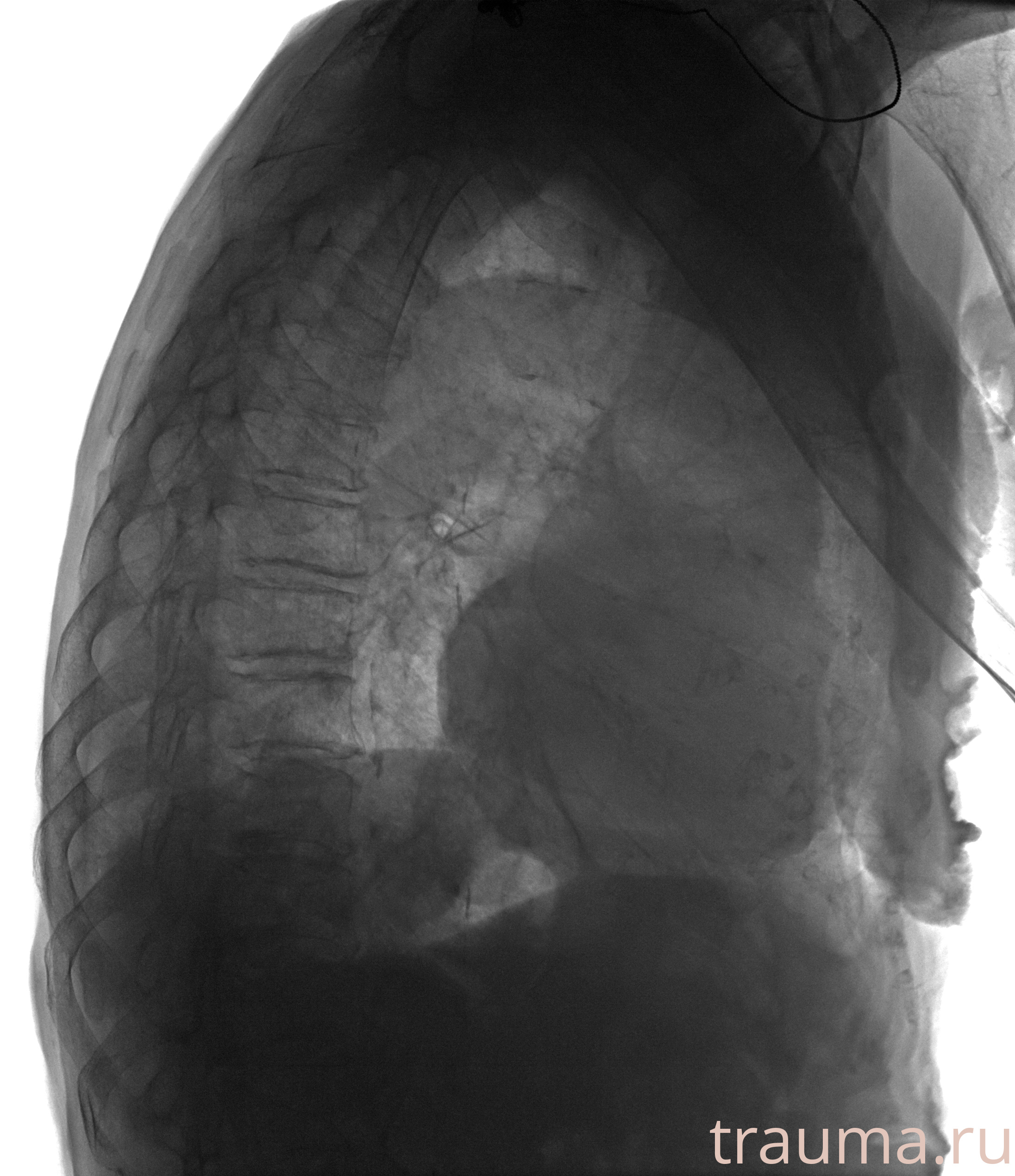 Рентген на дому: по вашему адресу приезжает врач-рентгенолог, травматолог-ортопед с мобильным рентгеновским аппаратом, проводит диагностику травмы или заболевания, делает необходимые рентгенограммы, дает рекомендации по дальнейшему лечению. Получить качественные снимки в домашних условиях возможно благодаря уникальной методике, разработанной МосРентген Центром для института  Склифосовского