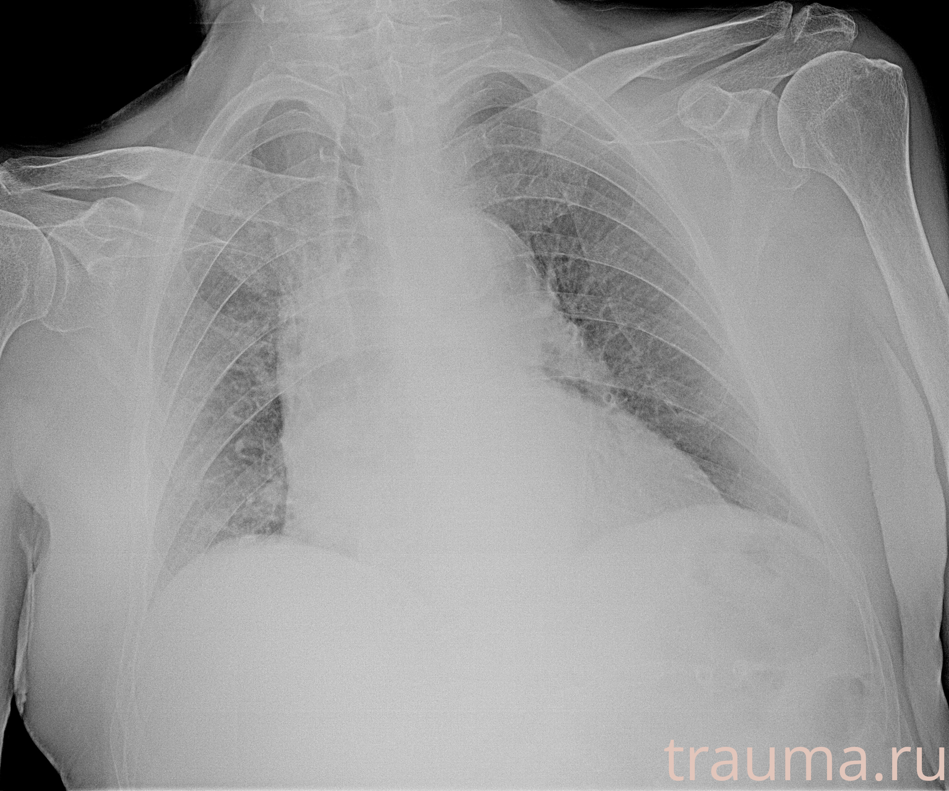 Рентген на дому: по вашему адресу приезжает врач-рентгенолог, травматолог-ортопед с мобильным рентгеновским аппаратом, проводит диагностику травмы или заболевания, делает необходимые рентгенограммы, дает рекомендации по дальнейшему лечению. Получить качественные снимки в домашних условиях возможно благодаря уникальной методике, разработанной МосРентген Центром для института  Склифосовского