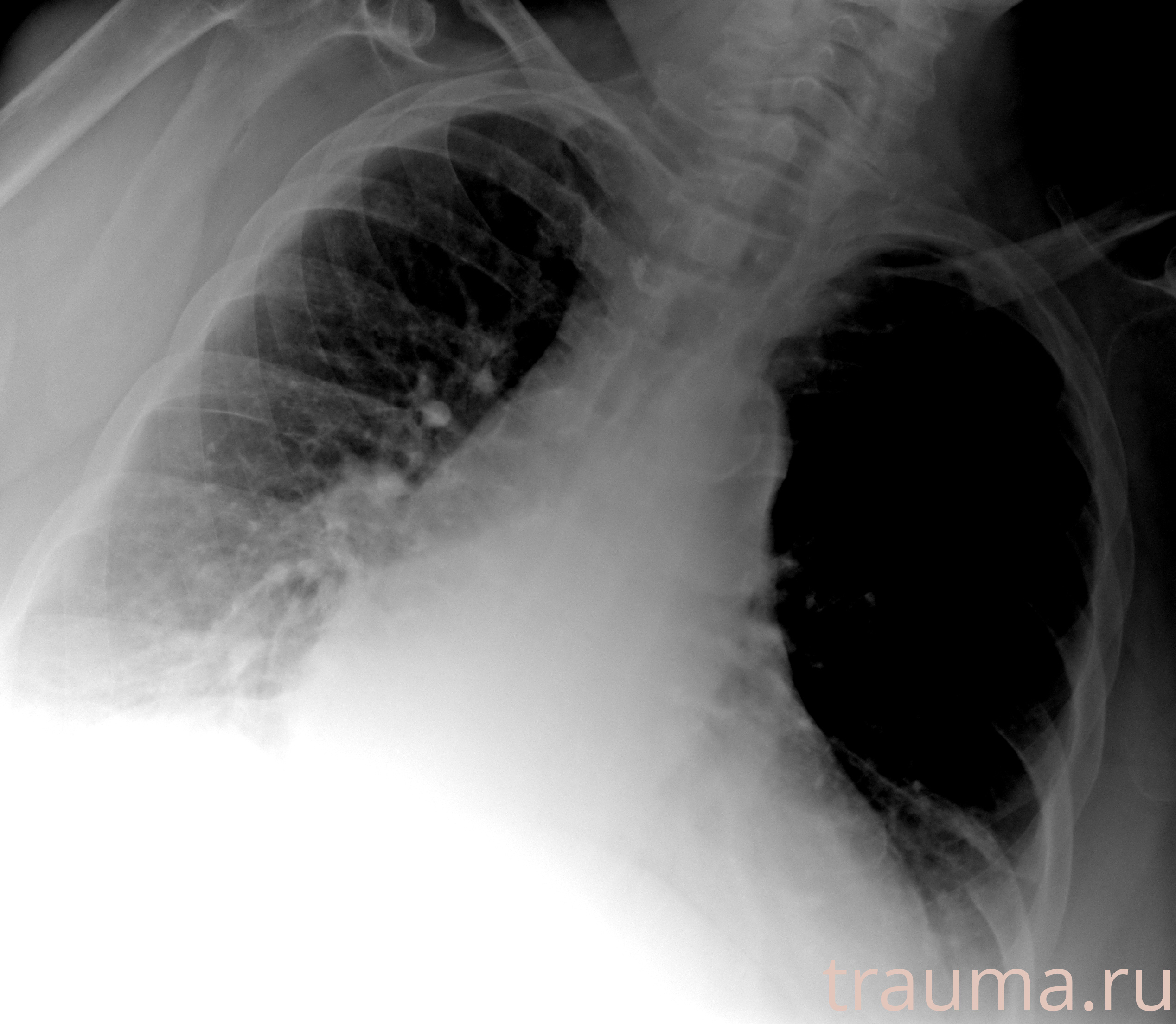 Рентген на дому: по вашему адресу приезжает врач-рентгенолог, травматолог-ортопед с мобильным рентгеновским аппаратом, проводит диагностику травмы или заболевания, делает необходимые рентгенограммы, дает рекомендации по дальнейшему лечению. Получить качественные снимки в домашних условиях возможно благодаря уникальной методике, разработанной МосРентген Центром для института  Склифосовского