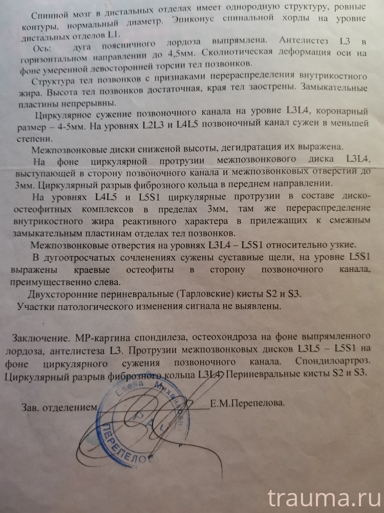 Рентген на дому: по вашему адресу приезжает врач-рентгенолог, травматолог-ортопед с мобильным рентгеновским аппаратом, проводит диагностику травмы или заболевания, делает необходимые рентгенограммы, дает рекомендации по дальнейшему лечению. Получить качественные снимки в домашних условиях возможно благодаря уникальной методике, разработанной МосРентген Центром для института  Склифосовского