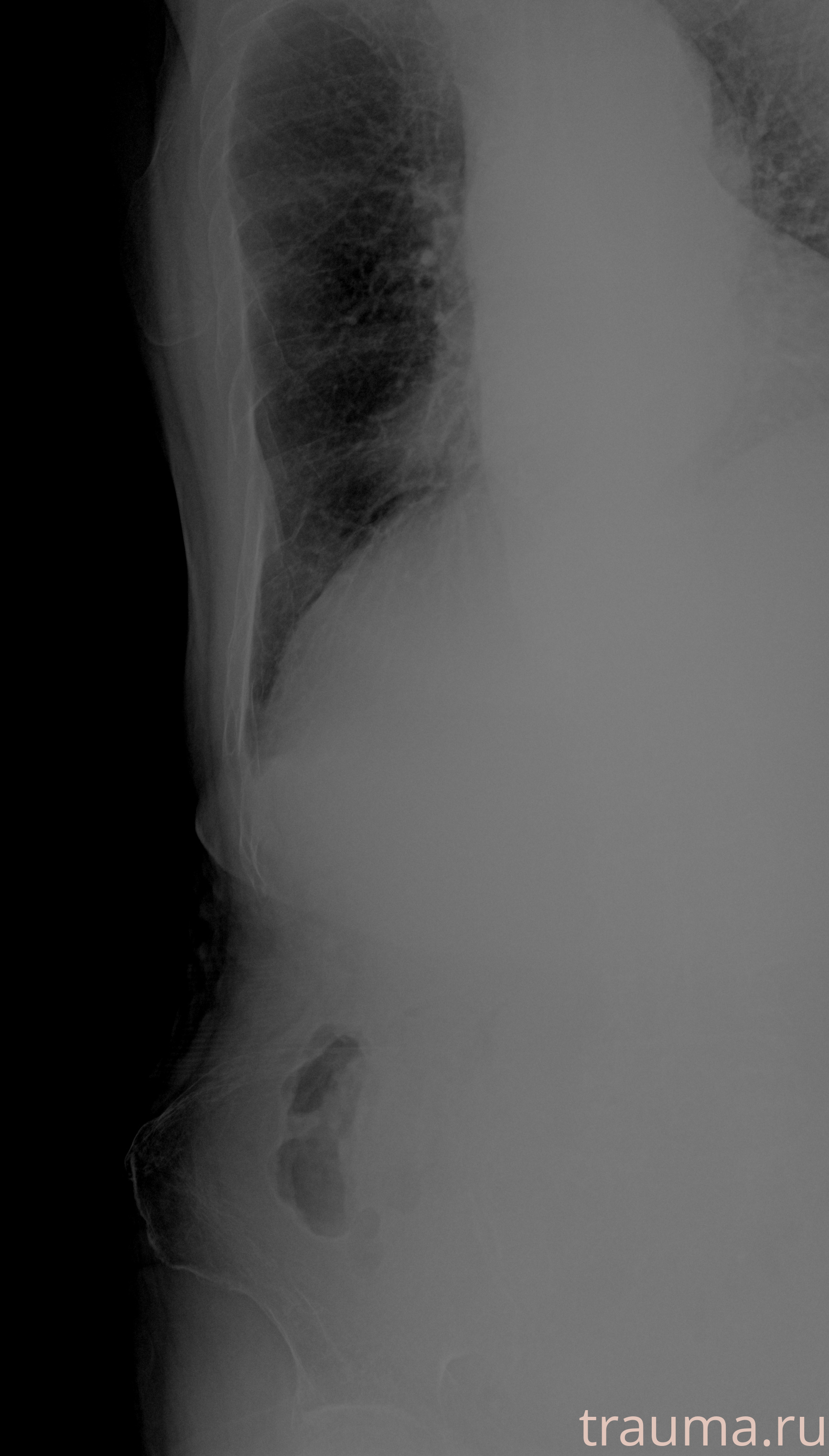Рентген на дому: по вашему адресу приезжает врач-рентгенолог, травматолог-ортопед с мобильным рентгеновским аппаратом, проводит диагностику травмы или заболевания, делает необходимые рентгенограммы, дает рекомендации по дальнейшему лечению. Получить качественные снимки в домашних условиях возможно благодаря уникальной методике, разработанной МосРентген Центром для института  Склифосовского