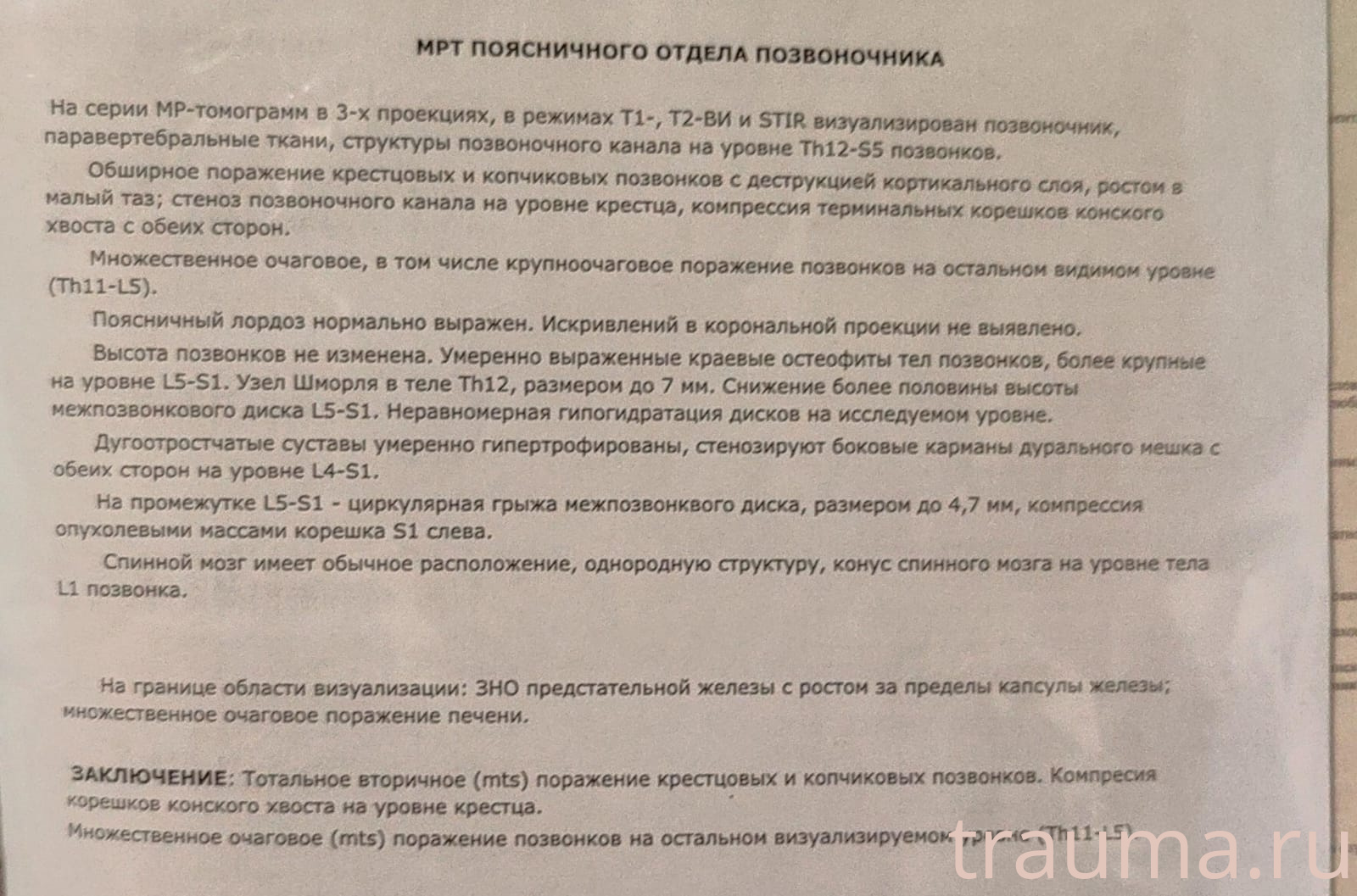 Рентген на дому: по вашему адресу приезжает врач-рентгенолог, травматолог-ортопед с мобильным рентгеновским аппаратом, проводит диагностику травмы или заболевания, делает необходимые рентгенограммы, дает рекомендации по дальнейшему лечению. Получить качественные снимки в домашних условиях возможно благодаря уникальной методике, разработанной МосРентген Центром для института  Склифосовского