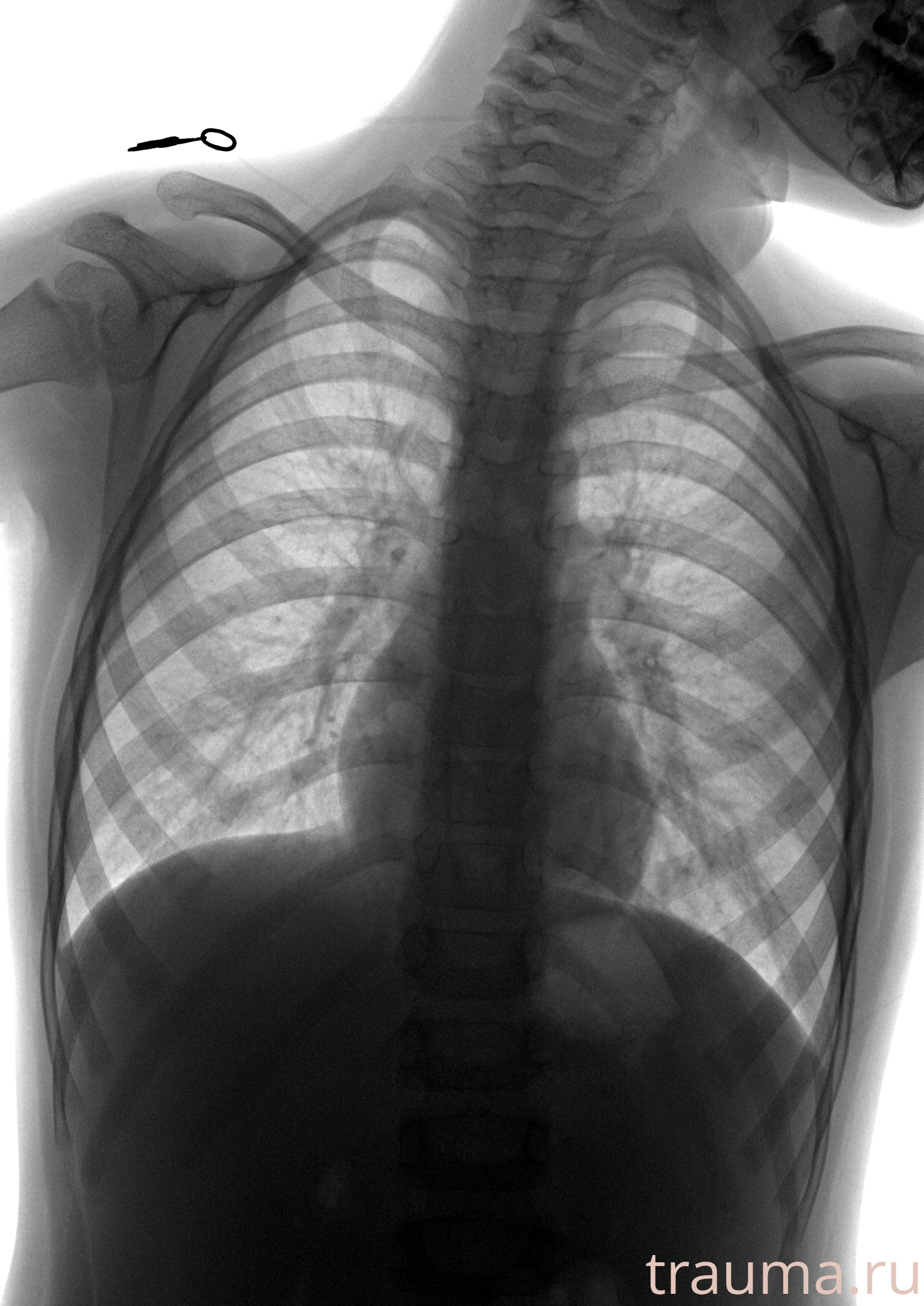 Рентген на дому: по вашему адресу приезжает врач-рентгенолог, травматолог-ортопед с мобильным рентгеновским аппаратом, проводит диагностику травмы или заболевания, делает необходимые рентгенограммы, дает рекомендации по дальнейшему лечению. Получить качественные снимки в домашних условиях возможно благодаря уникальной методике, разработанной МосРентген Центром для института  Склифосовского