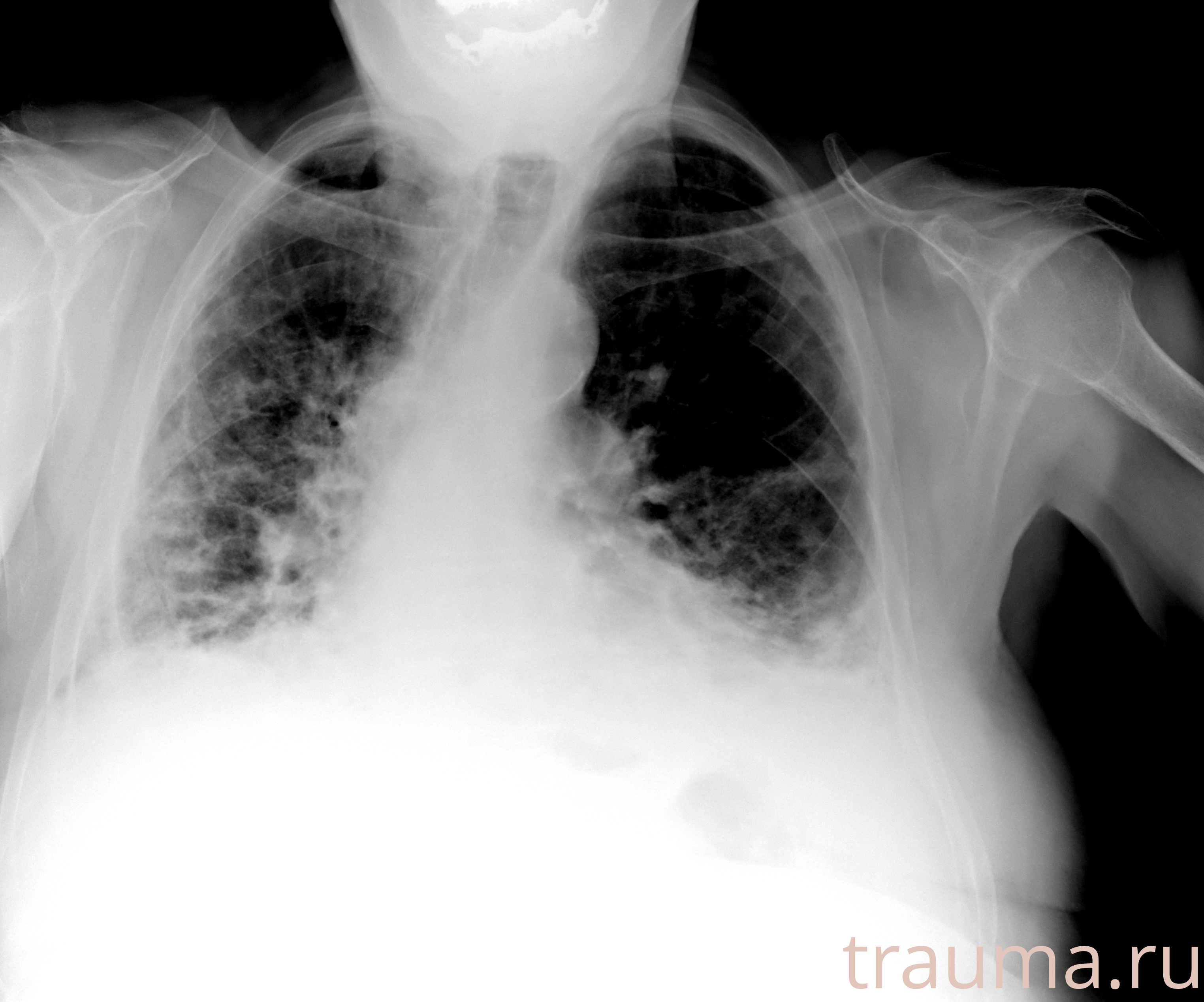 Рентген на дому: по вашему адресу приезжает врач-рентгенолог, травматолог-ортопед с мобильным рентгеновским аппаратом, проводит диагностику травмы или заболевания, делает необходимые рентгенограммы, дает рекомендации по дальнейшему лечению. Получить качественные снимки в домашних условиях возможно благодаря уникальной методике, разработанной МосРентген Центром для института  Склифосовского