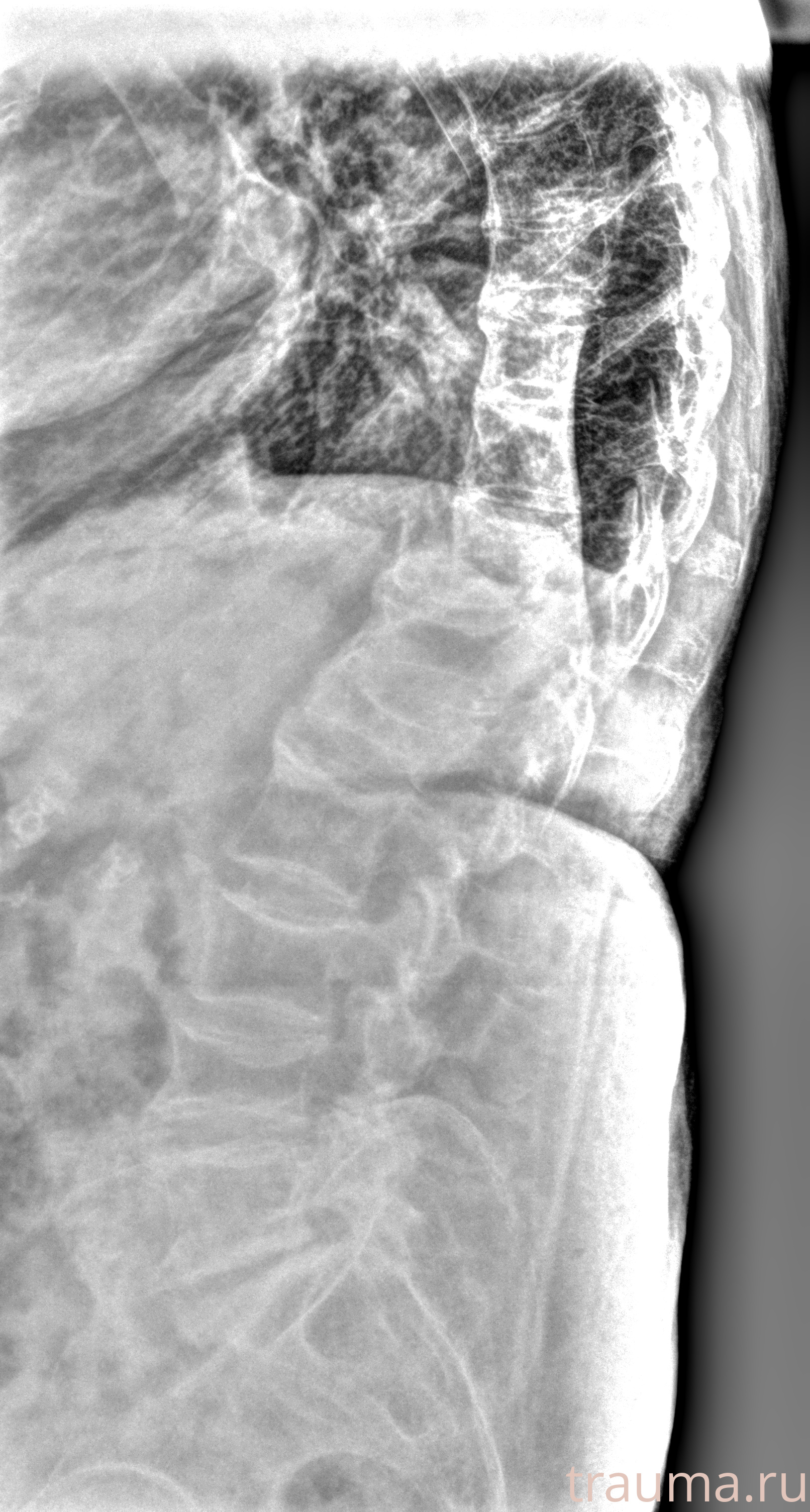 Рентген на дому: по вашему адресу приезжает врач-рентгенолог, травматолог-ортопед с мобильным рентгеновским аппаратом, проводит диагностику травмы или заболевания, делает необходимые рентгенограммы, дает рекомендации по дальнейшему лечению. Получить качественные снимки в домашних условиях возможно благодаря уникальной методике, разработанной МосРентген Центром для института  Склифосовского