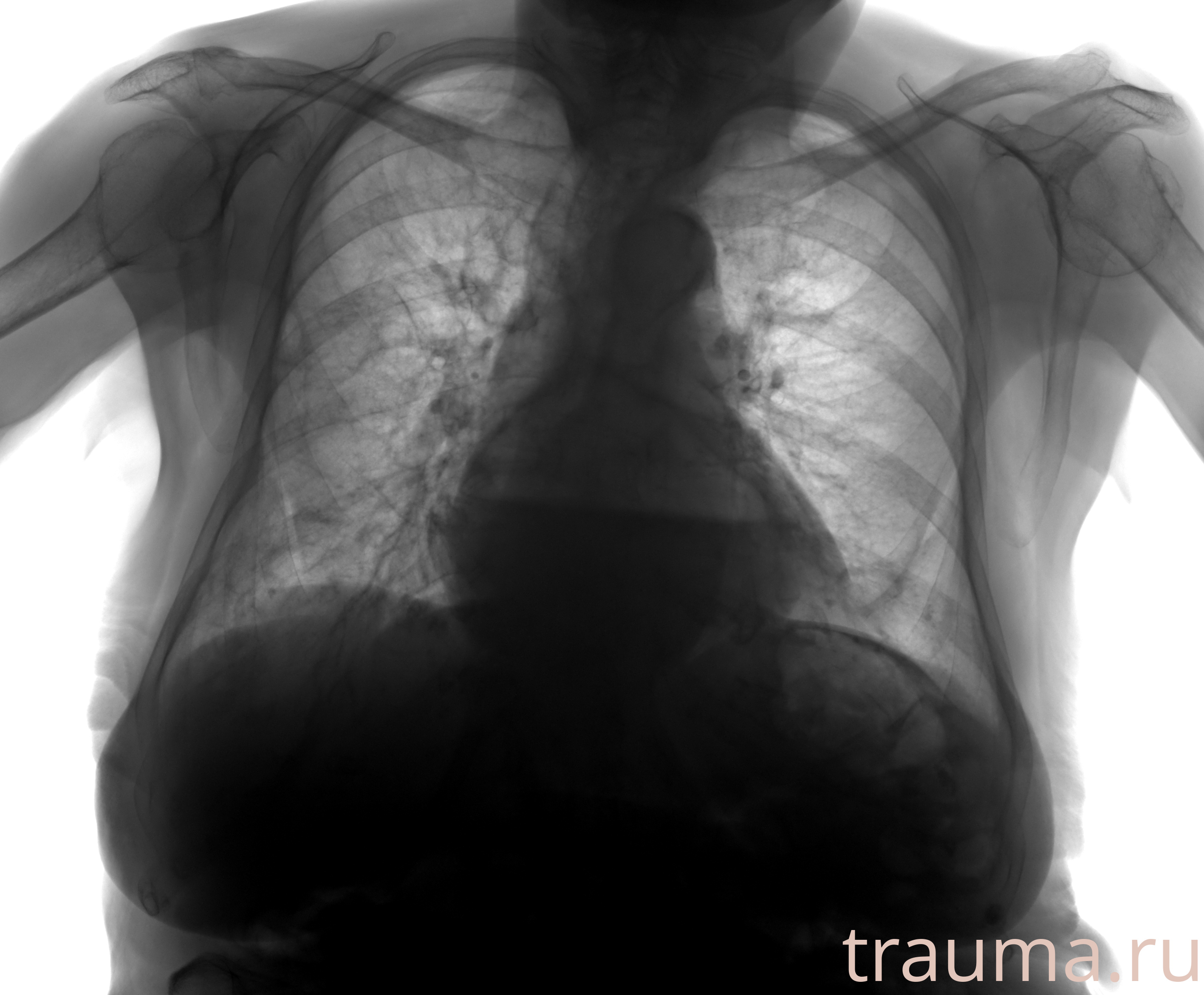 Рентген на дому: по вашему адресу приезжает врач-рентгенолог, травматолог-ортопед с мобильным рентгеновским аппаратом, проводит диагностику травмы или заболевания, делает необходимые рентгенограммы, дает рекомендации по дальнейшему лечению. Получить качественные снимки в домашних условиях возможно благодаря уникальной методике, разработанной МосРентген Центром для института  Склифосовского