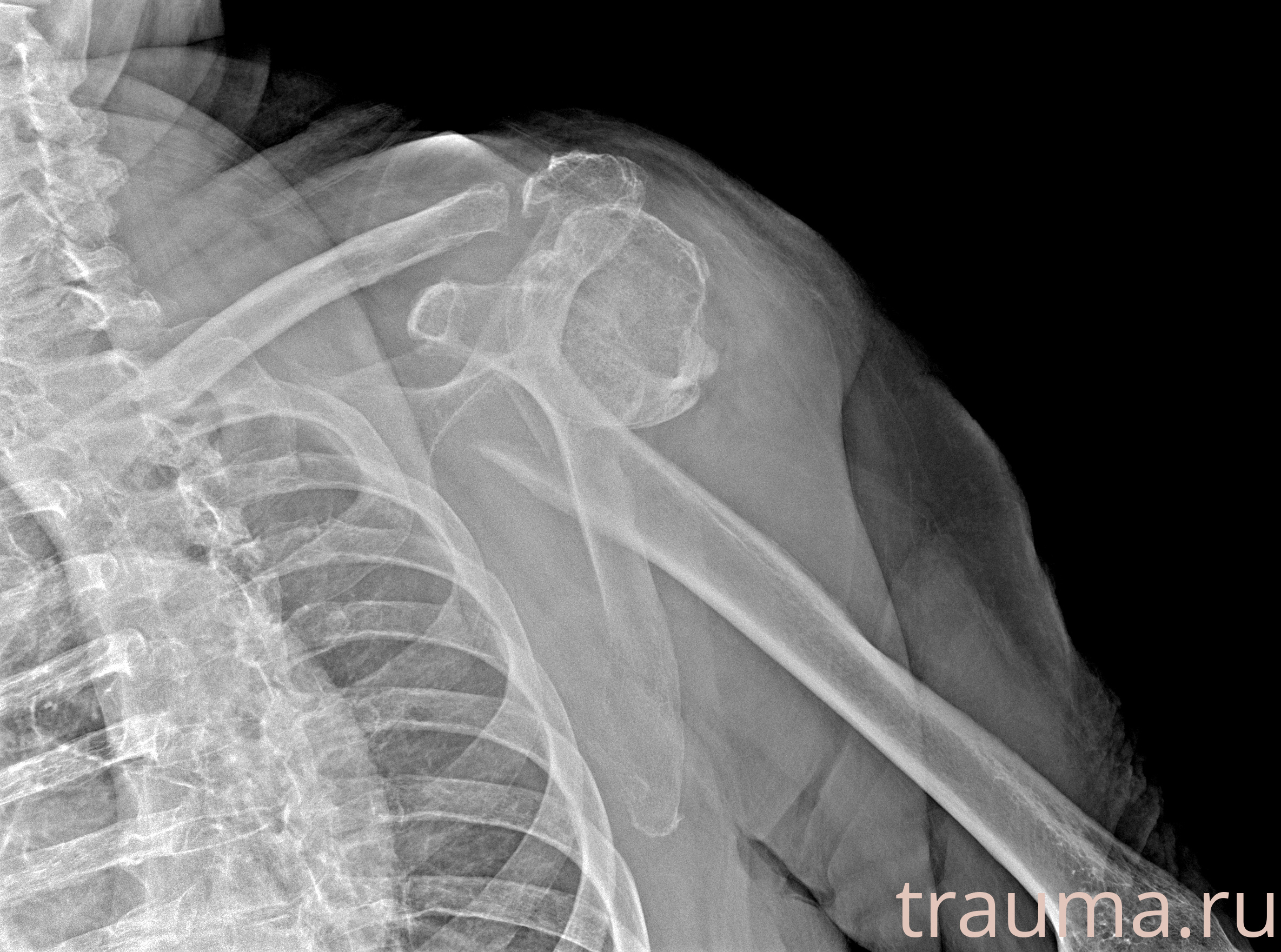 Рентген на дому: по вашему адресу приезжает врач-рентгенолог, травматолог-ортопед с мобильным рентгеновским аппаратом, проводит диагностику травмы или заболевания, делает необходимые рентгенограммы, дает рекомендации по дальнейшему лечению. Получить качественные снимки в домашних условиях возможно благодаря уникальной методике, разработанной МосРентген Центром для института  Склифосовского